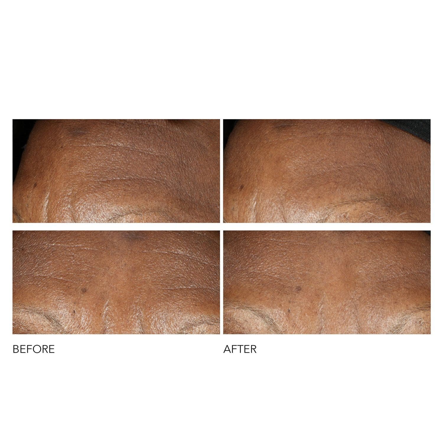 Advanced Retinol + Ferulic Intense Wrinkle Cream