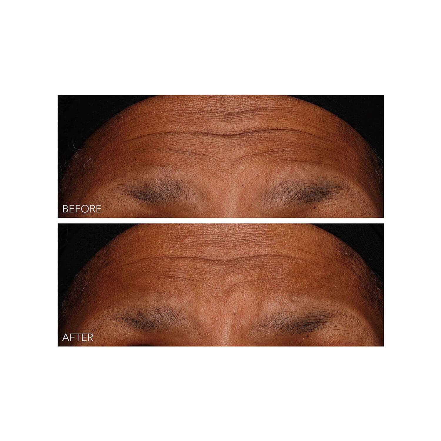DermInfusions™ - Fill + Repair Serum