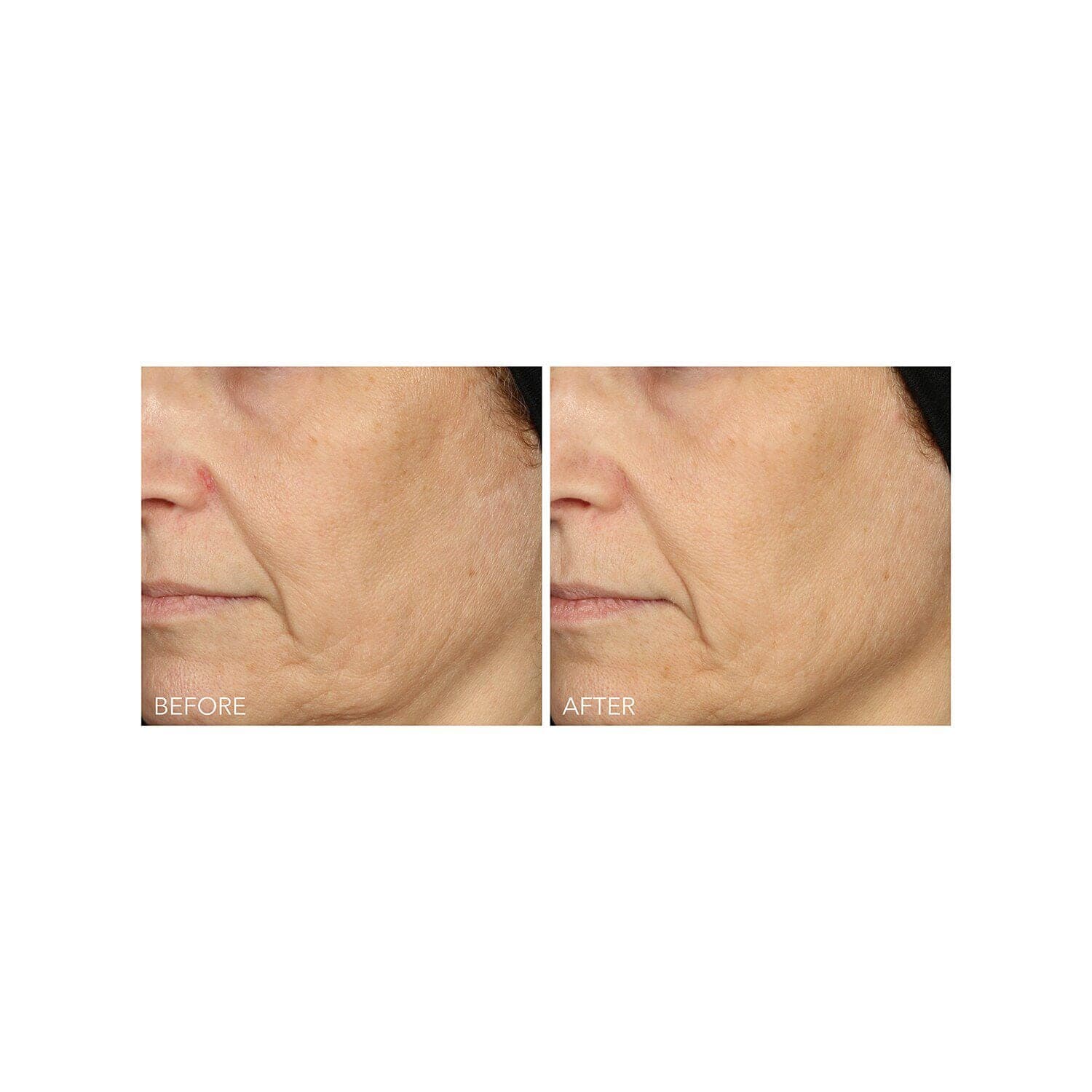 Vitamin C + Lactic 15% Vitamin C Firm & Bright Serum