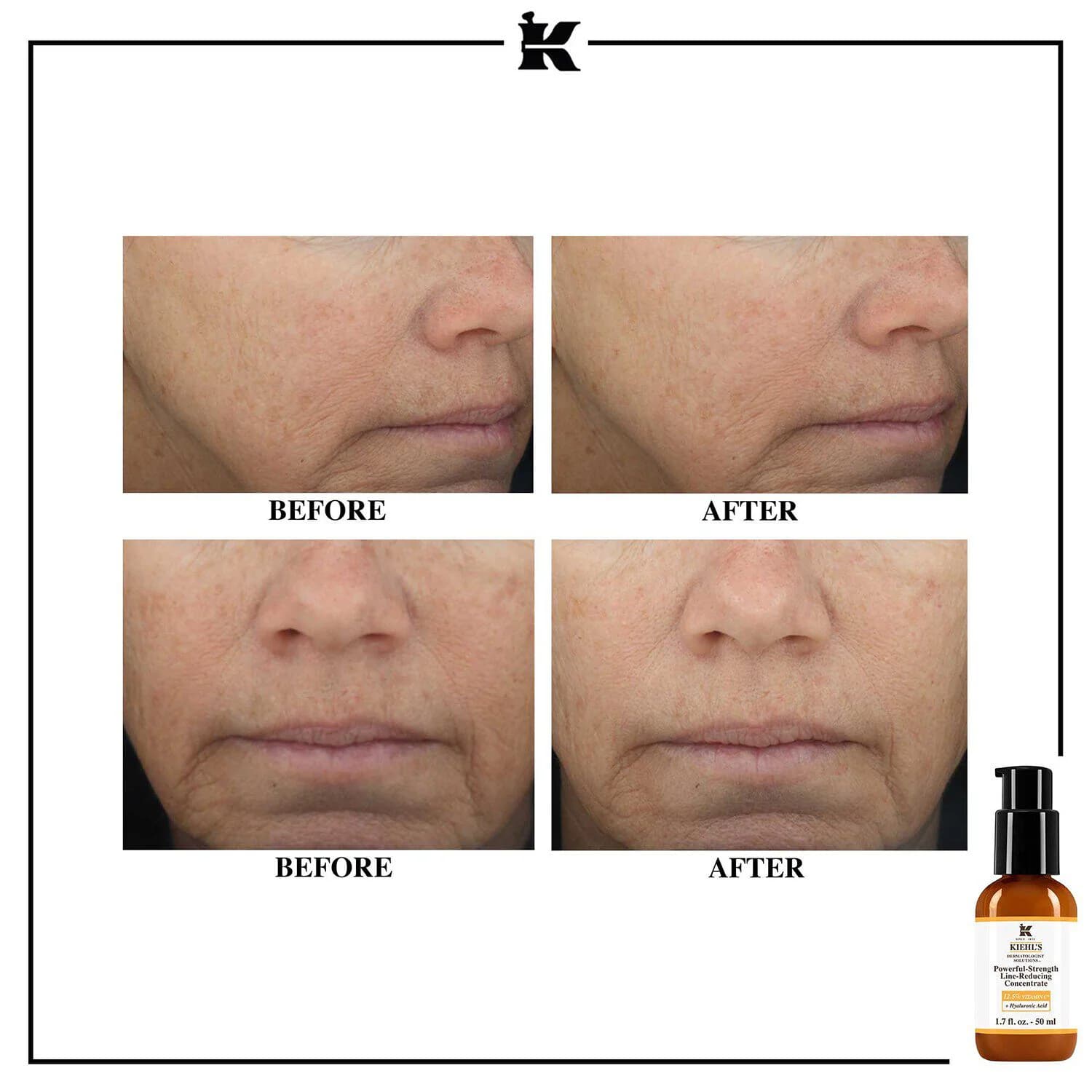 Powerful-Strength Line-Reducing Vitamin C Serum