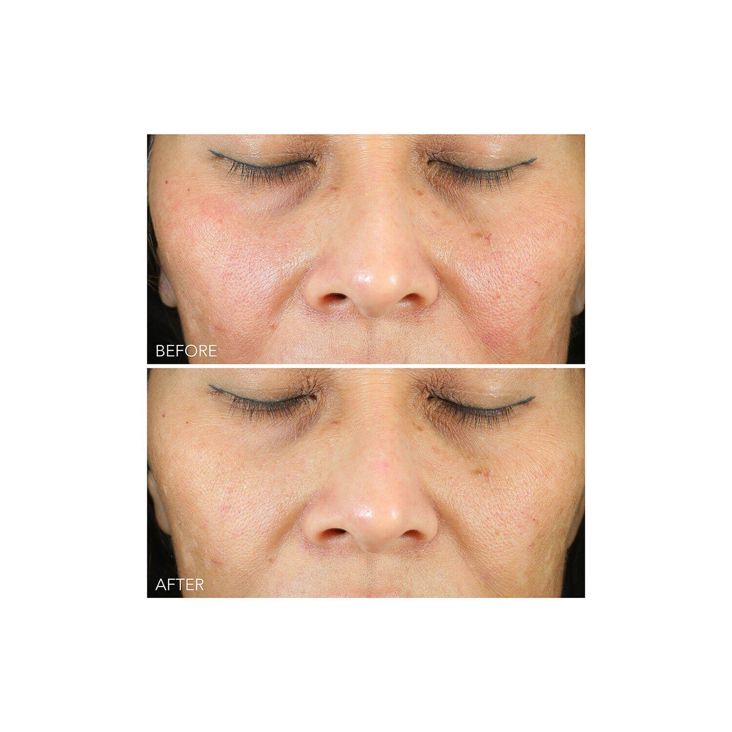Vitamin C + Lactic Oil-Free Radiant Moisturizer