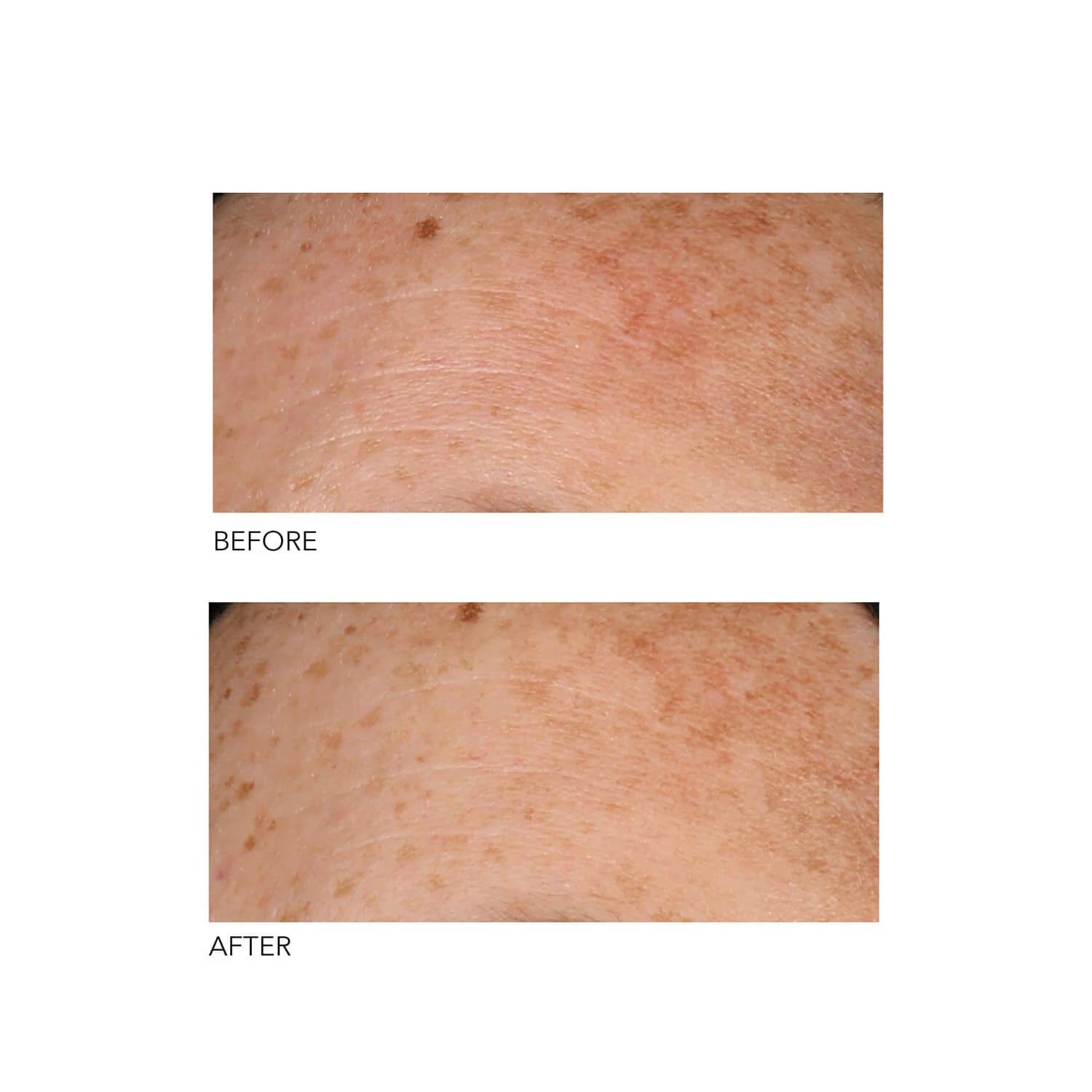 Alpha Beta® Universal Daily Peel 