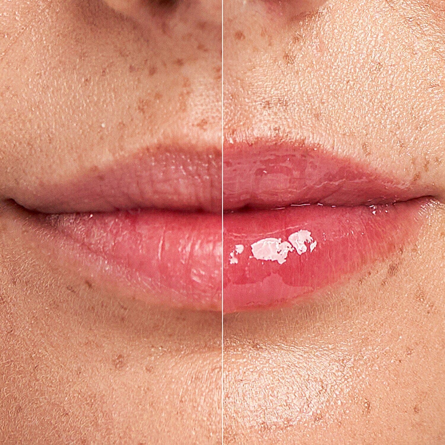 DermInfusions™ Plump + Repair Lip Treatment