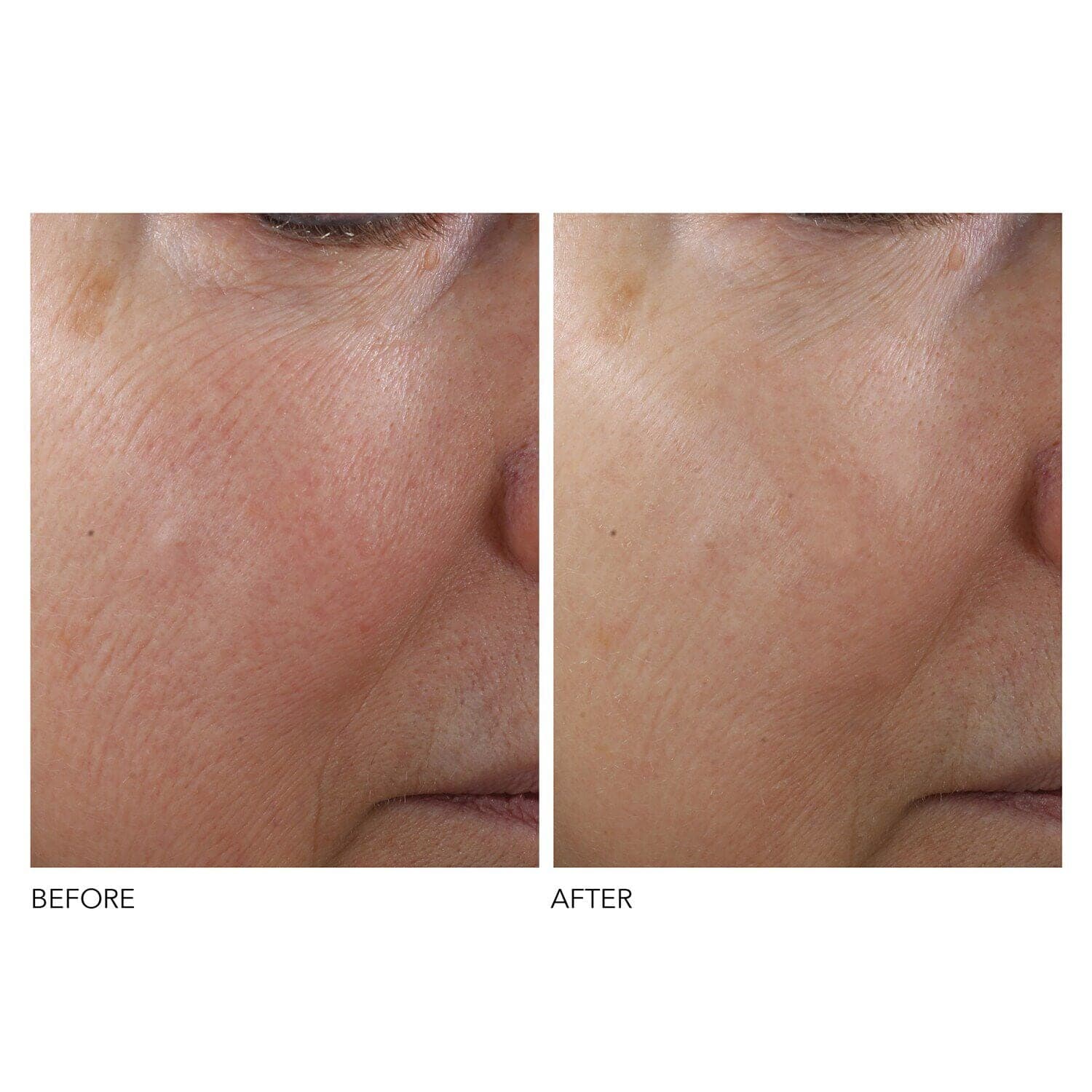 Advanced Retinol + Ferulic Texture Renewal Serum 