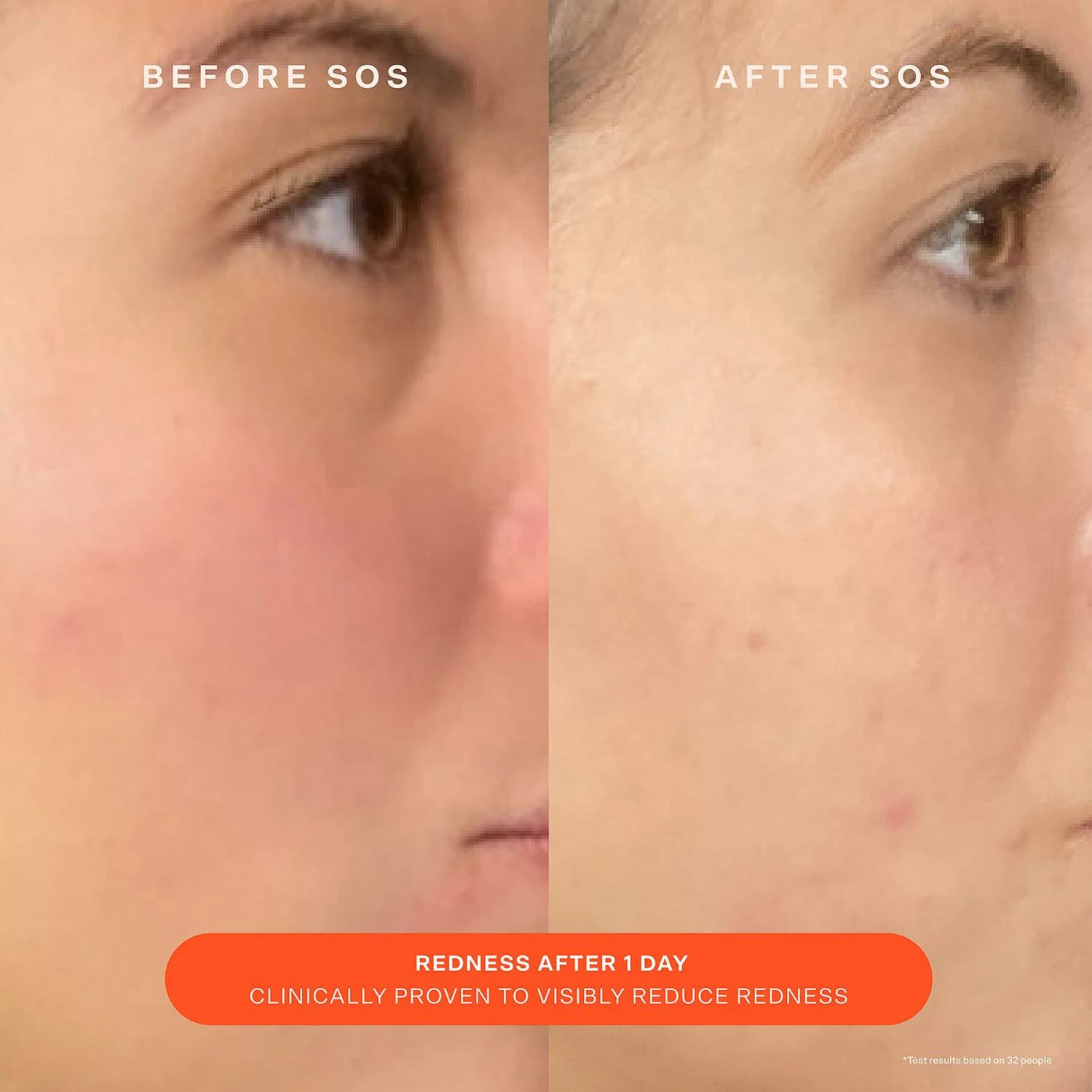 SOS Daily Barrier Recovery Cream - Facial Moisturizer