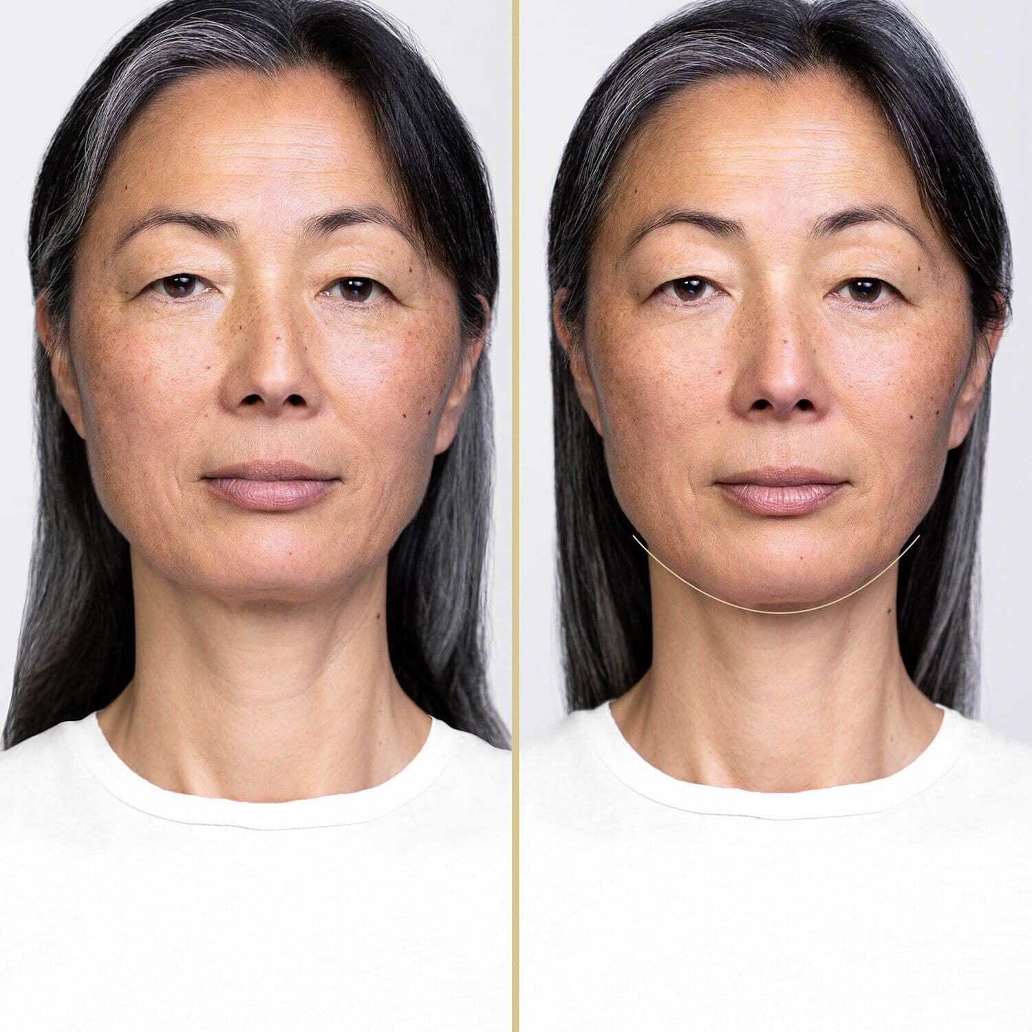 Vital Perfection - LiftDefine Radiance Night Concentrate