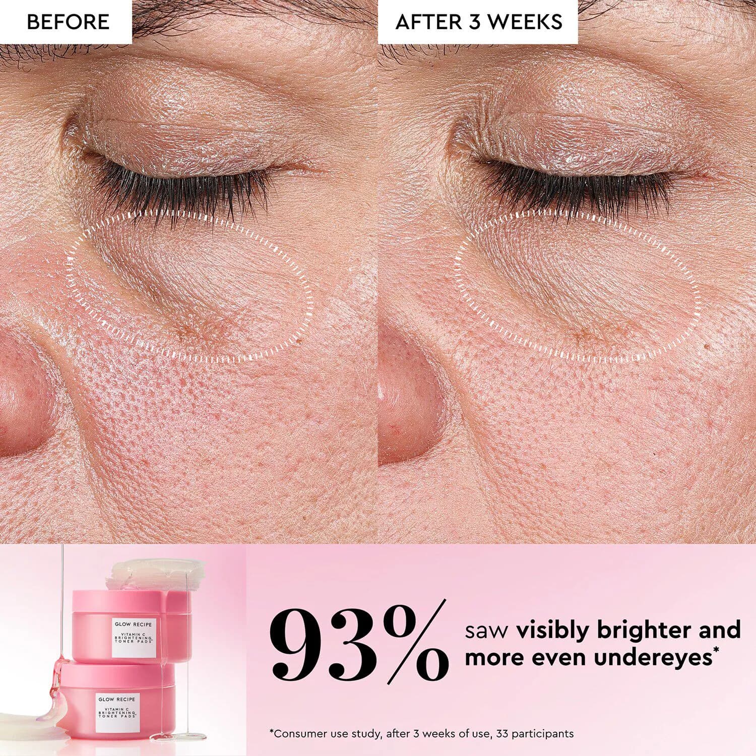 Vitamin C Brightening Korean Toner Pads for Undereye & Cheeks