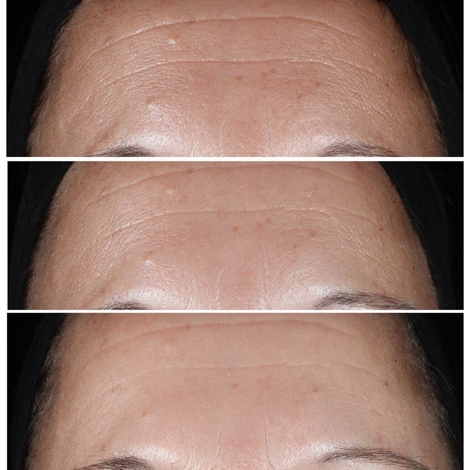 Smart Clinical Repair Wrinkle Correcting Serum 