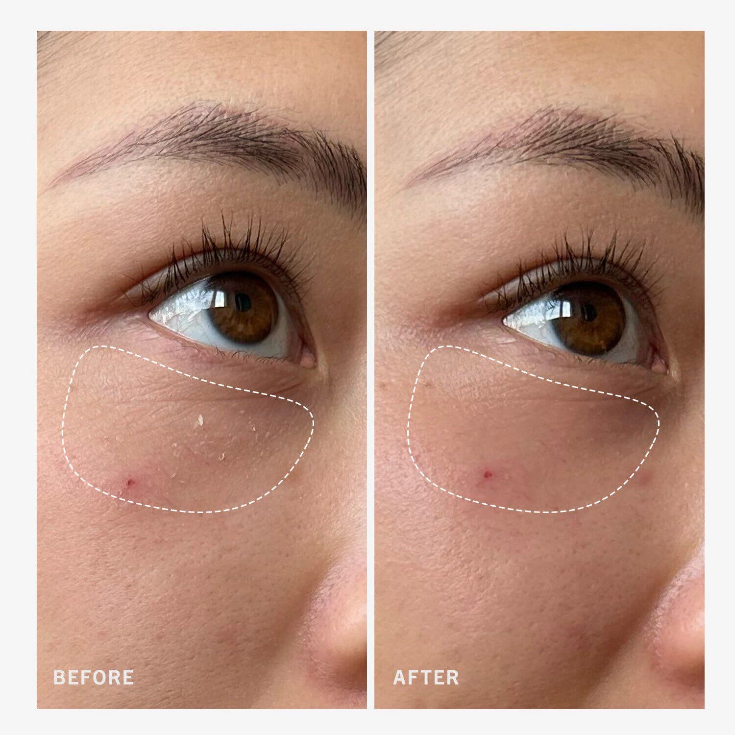 Ultra Repair Rescue Barrier Balm With Dimethicone