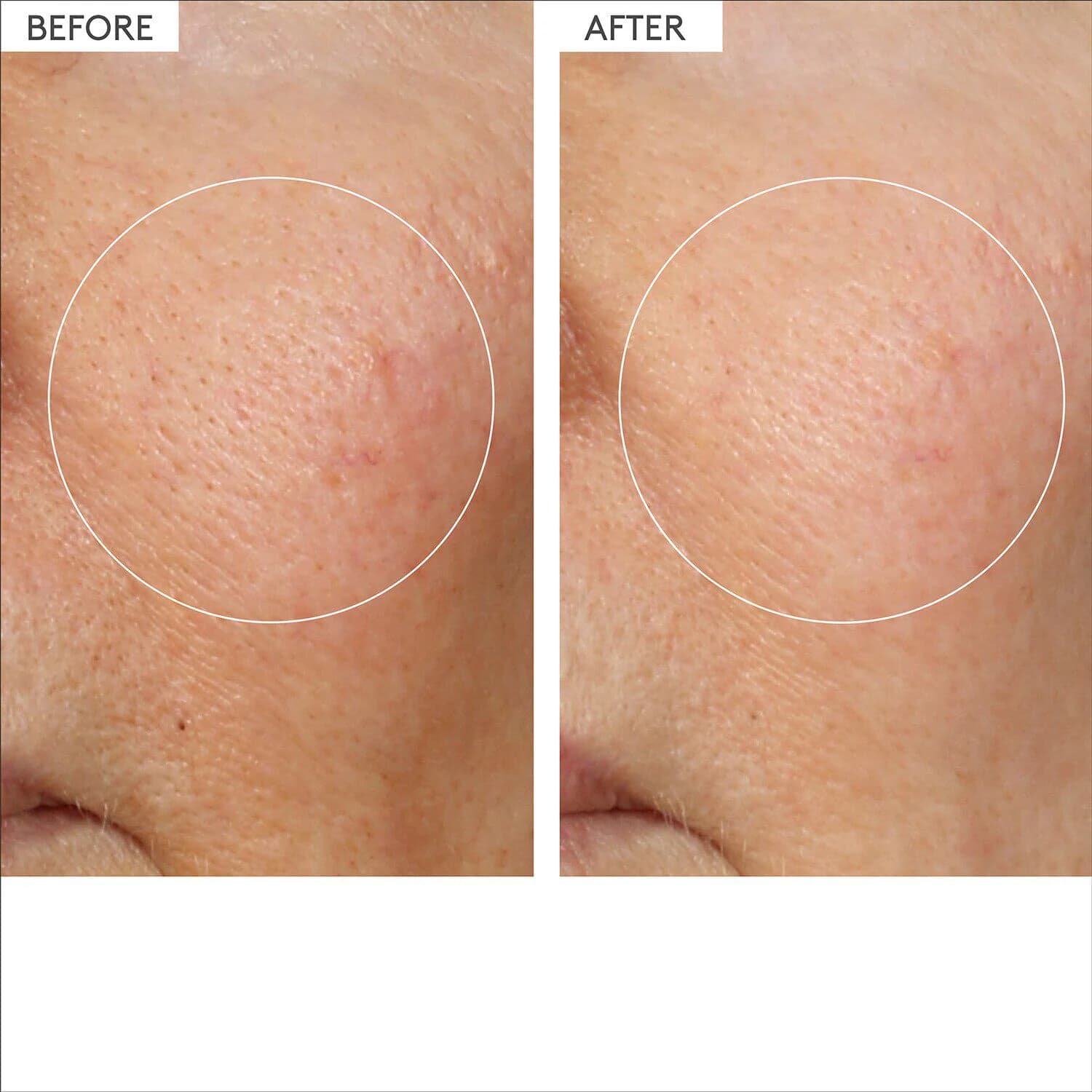 T.L.C. Framboos Glycolic Night Serum