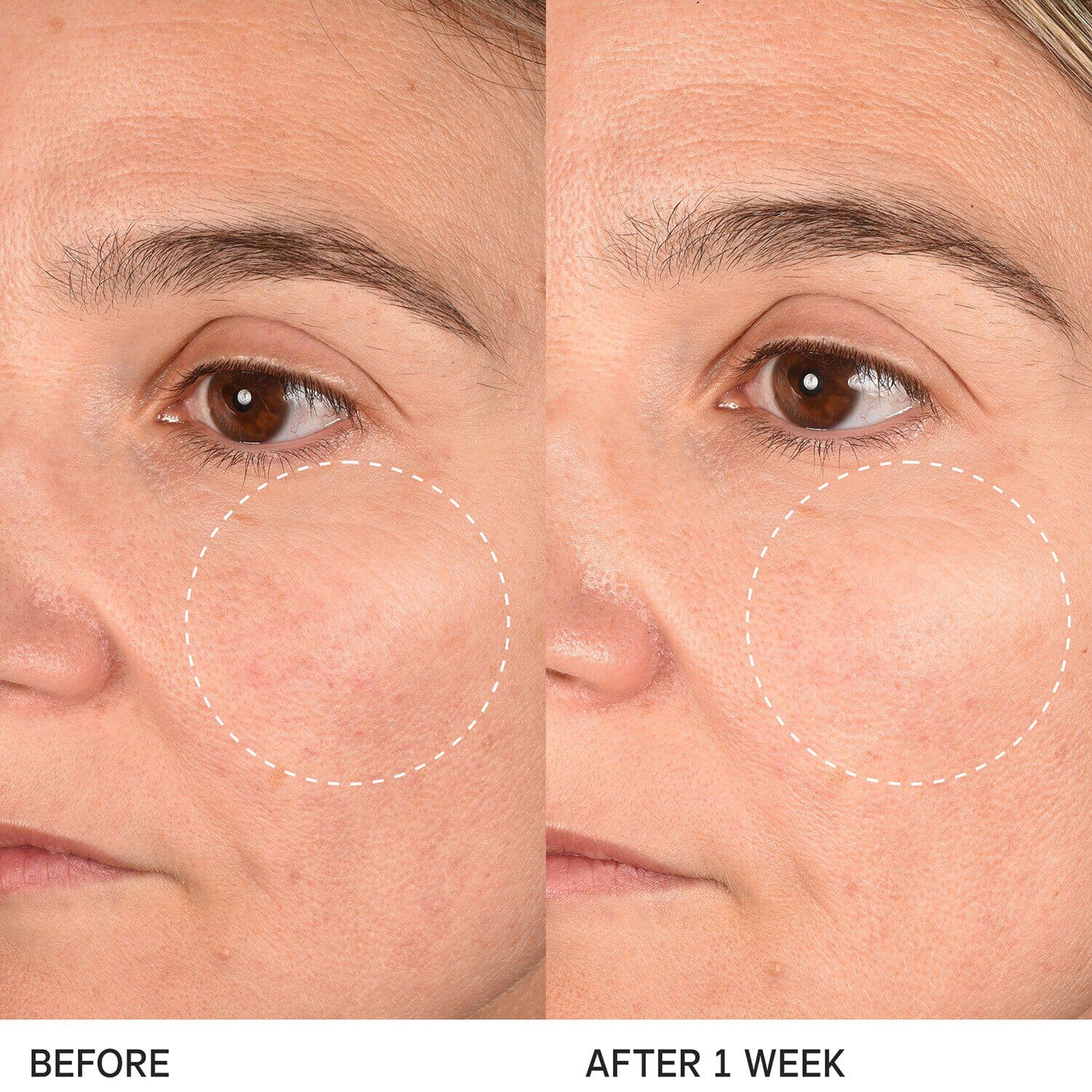 The Longevity Memory Cream