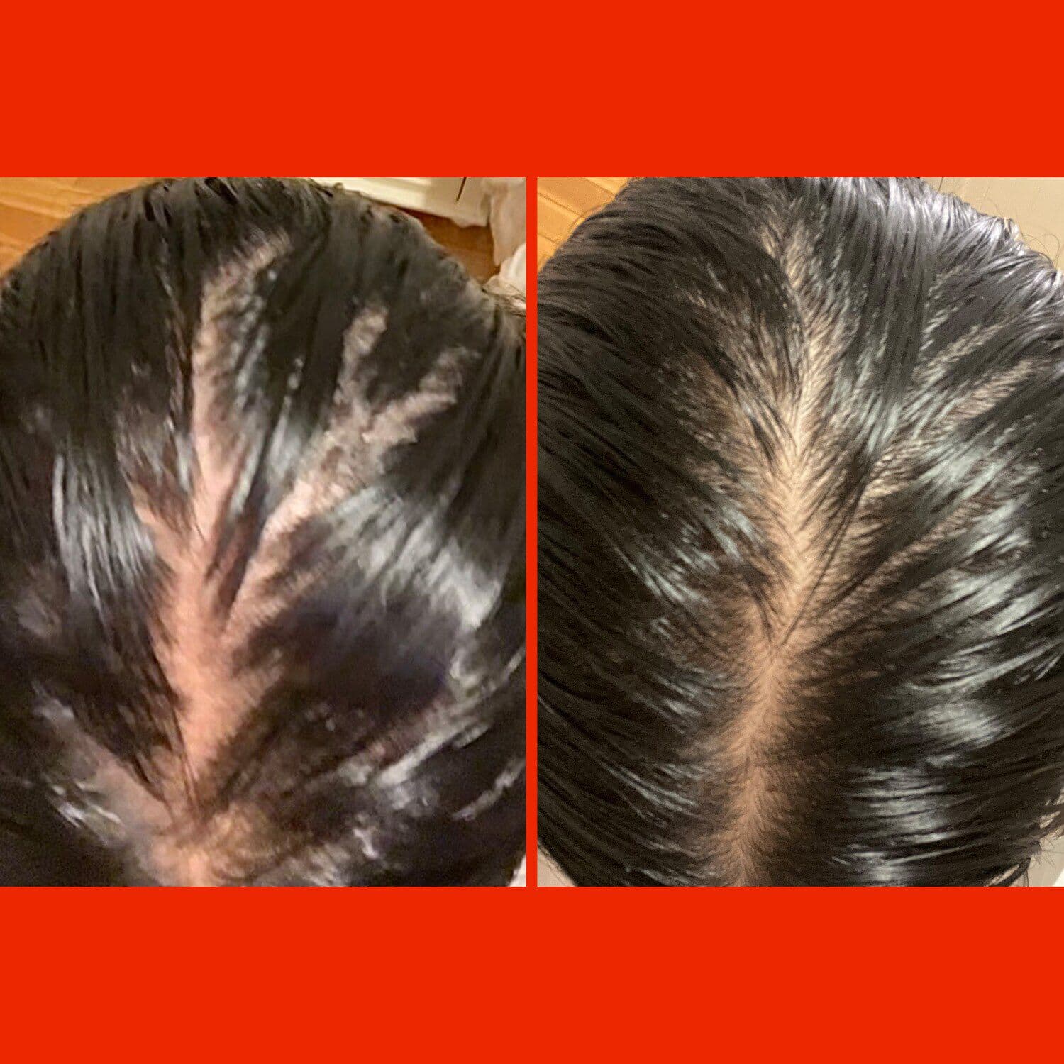 HoliRoots™ Hair Oil
