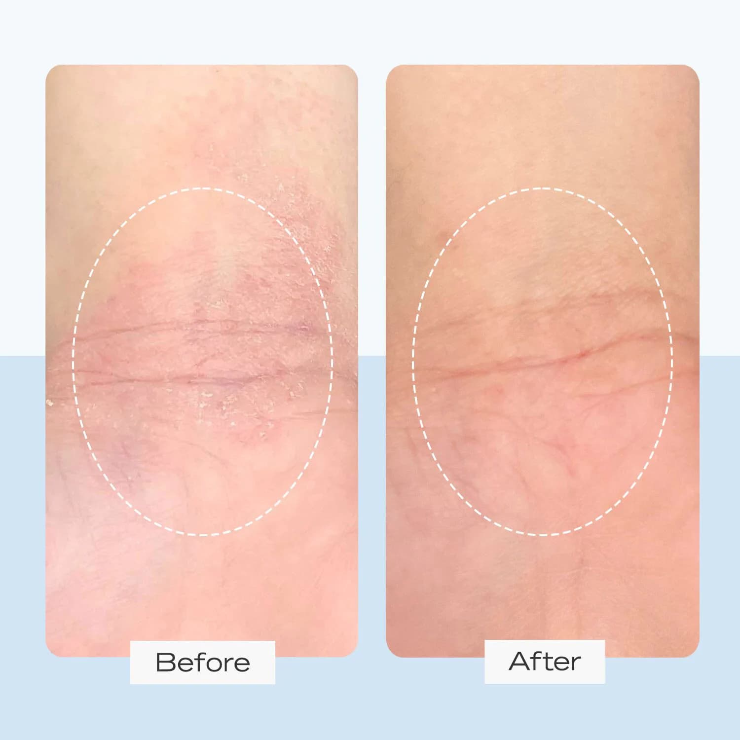 Ultra Repair Cream
