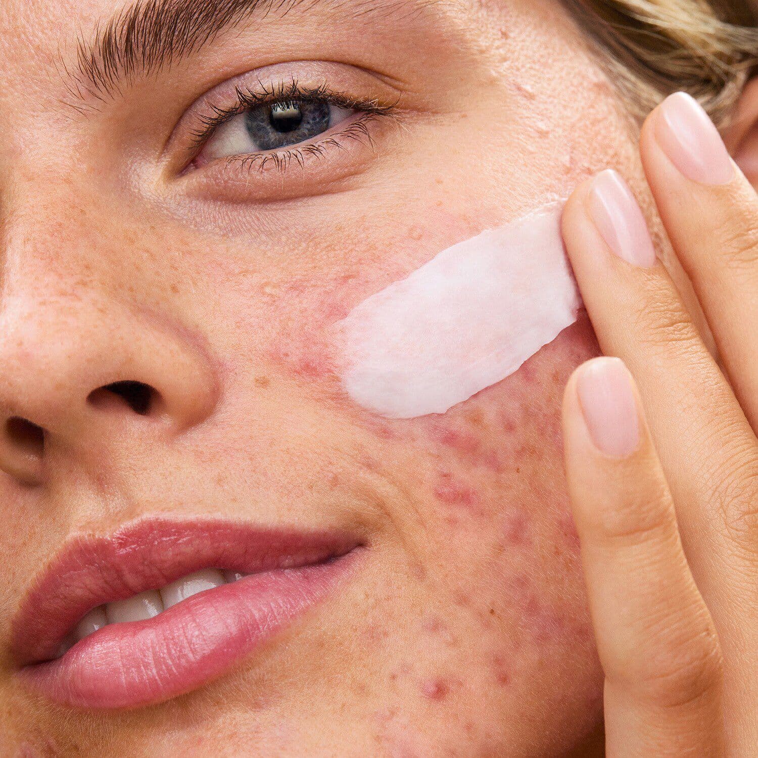 Ultra Repair Rescue Barrier Balm With Dimethicone