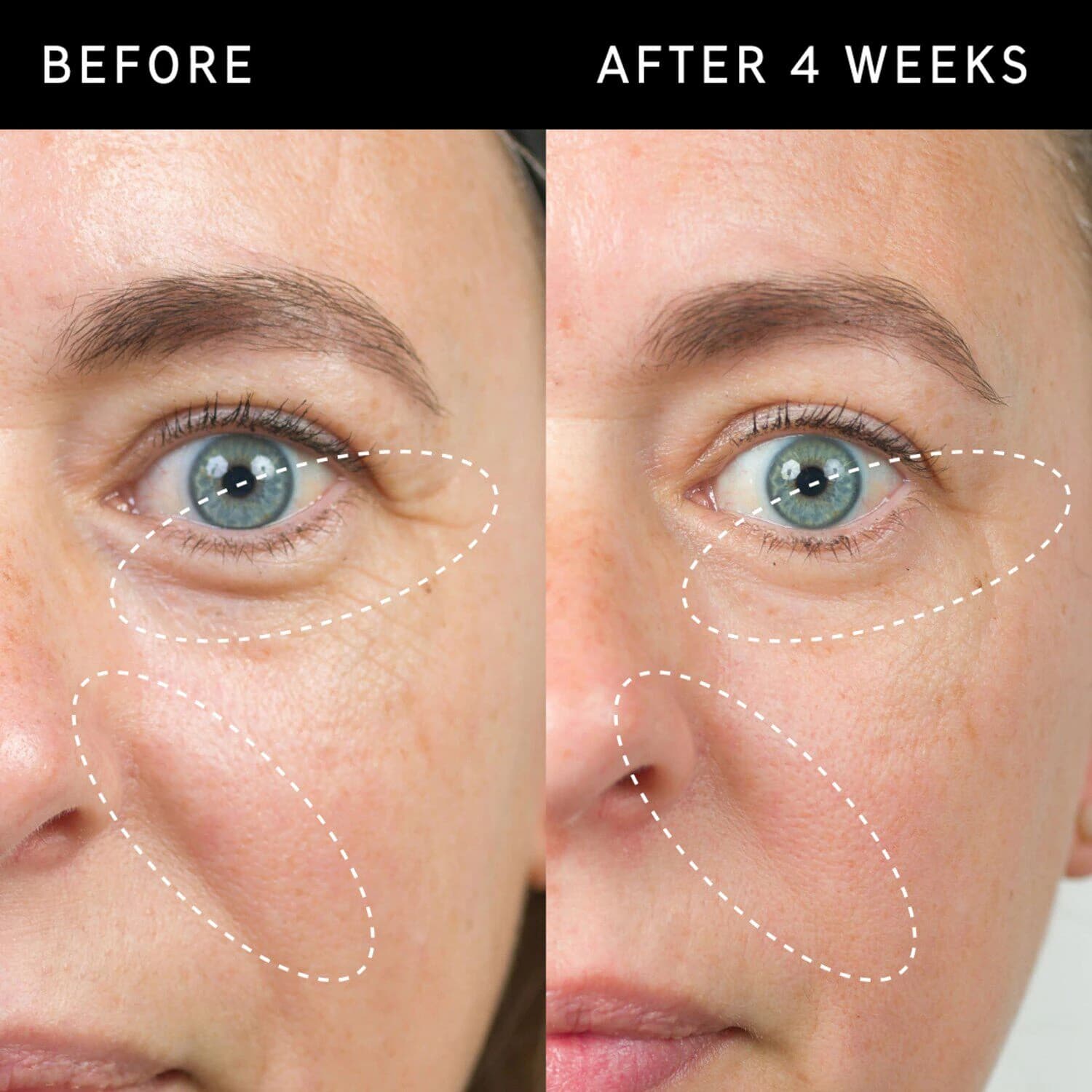Bio-Active Ceramide Repairing and Plumping Moisturizer
