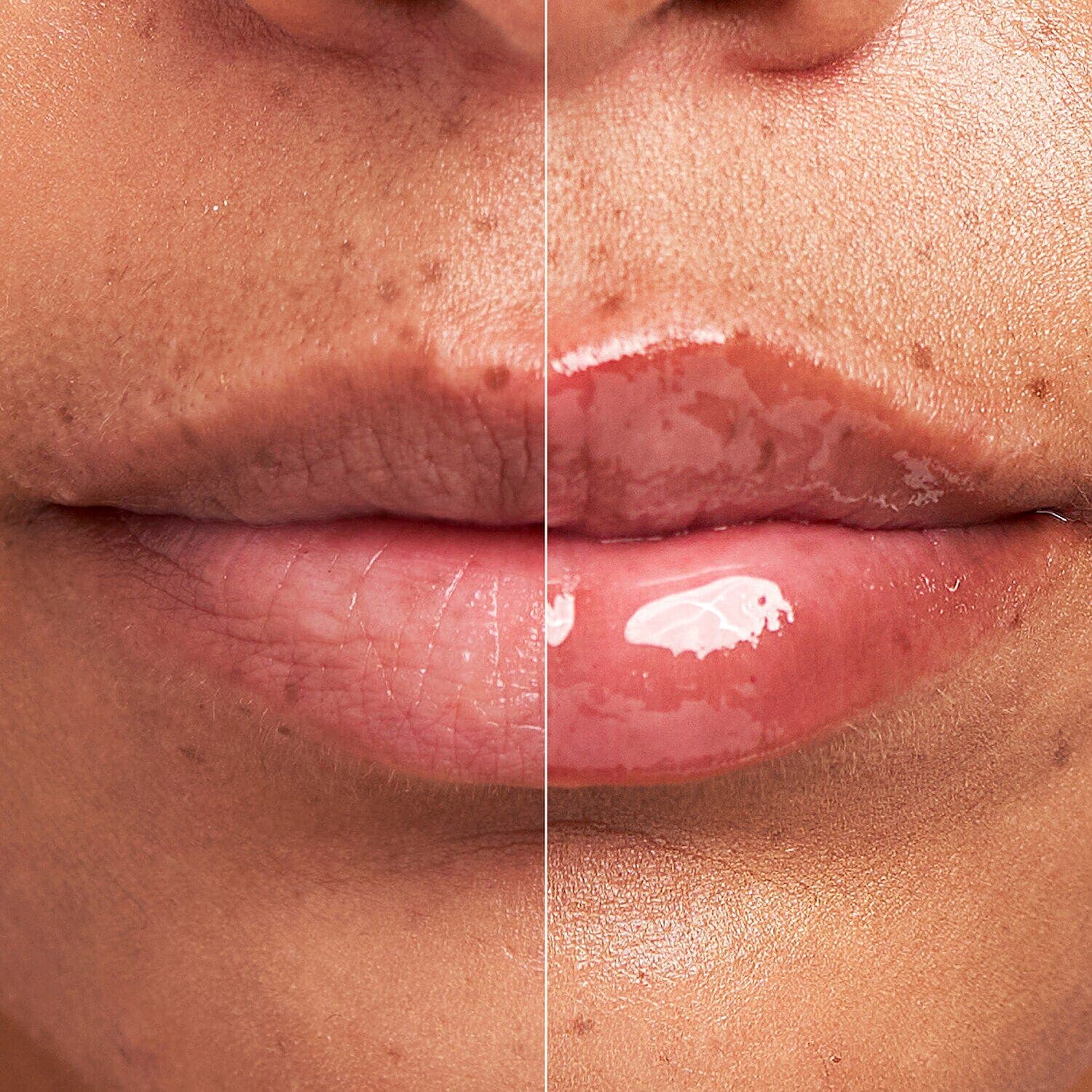 DermInfusions™ Plump + Repair Lip Treatment