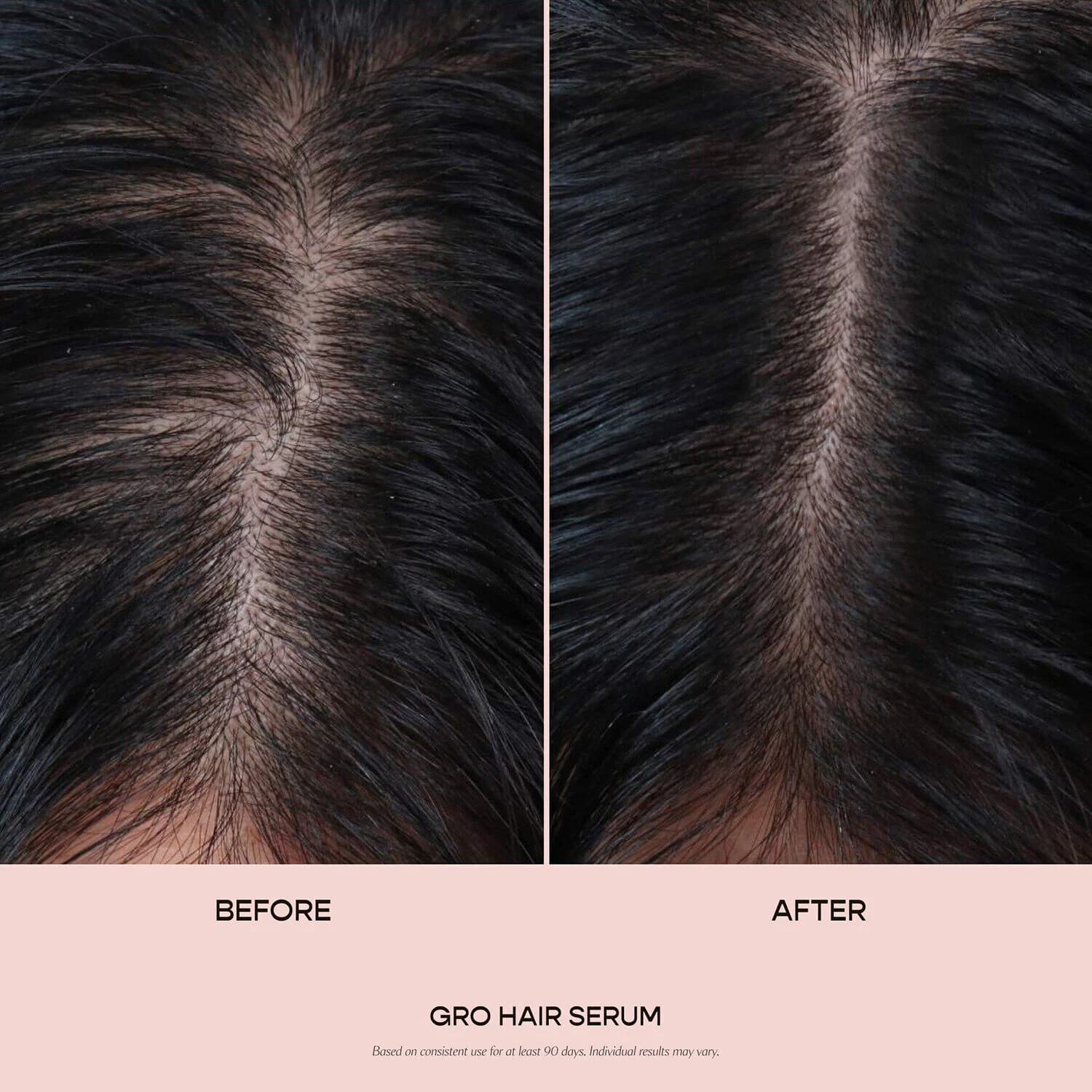Jumbo GRO Hair Serum