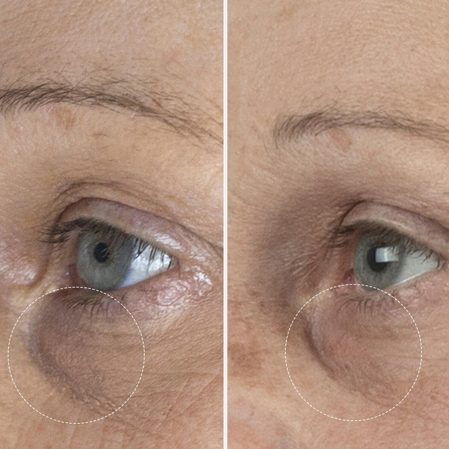 The Eye Cream - Nomad