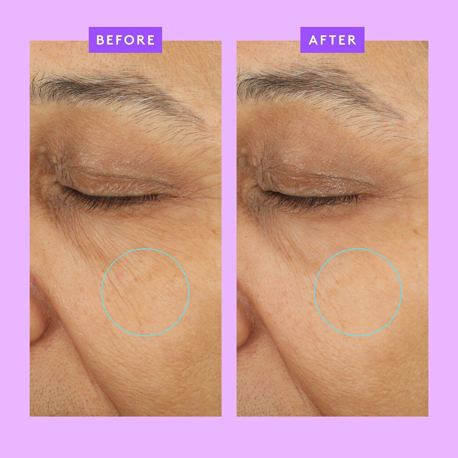 Ceramighty™ AF Eye Balm