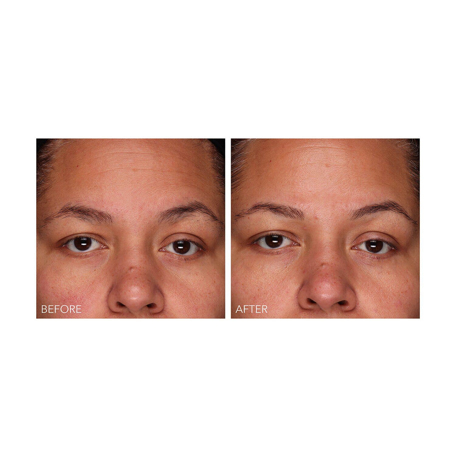 DermInfusions™ - Fill + Repair Serum