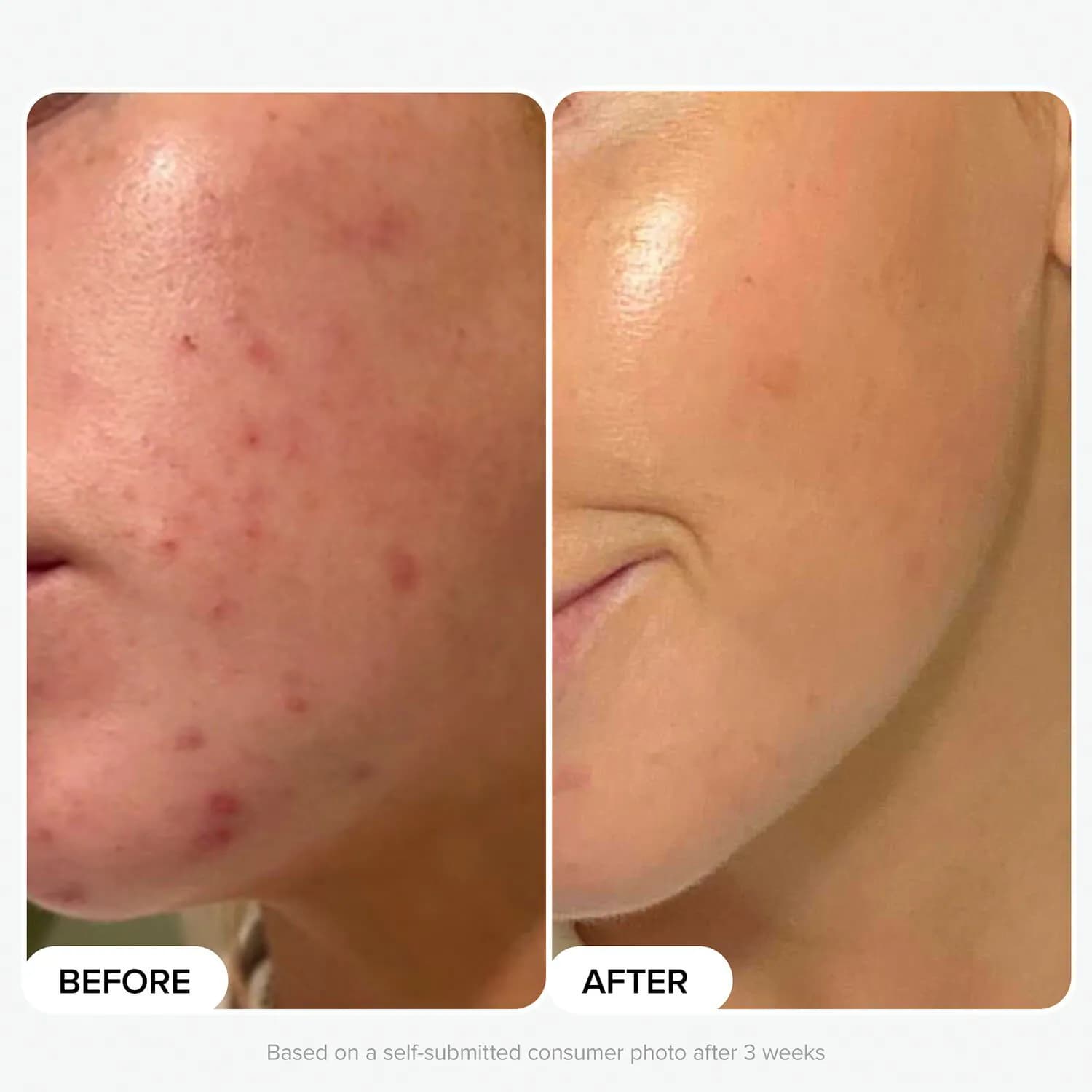 Protect And Glow Kit
