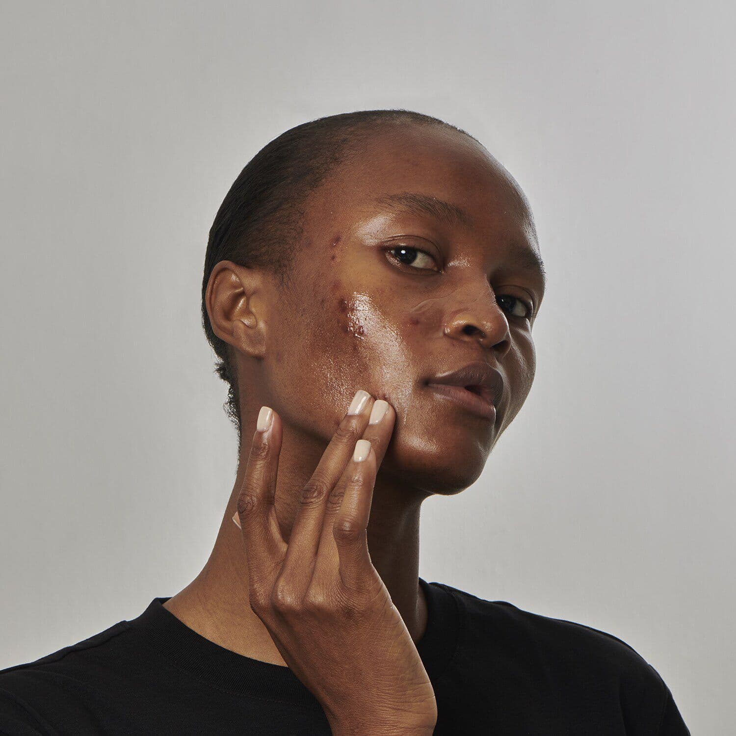 SuperSolutionsᐩ 20% Niacinamide Serum