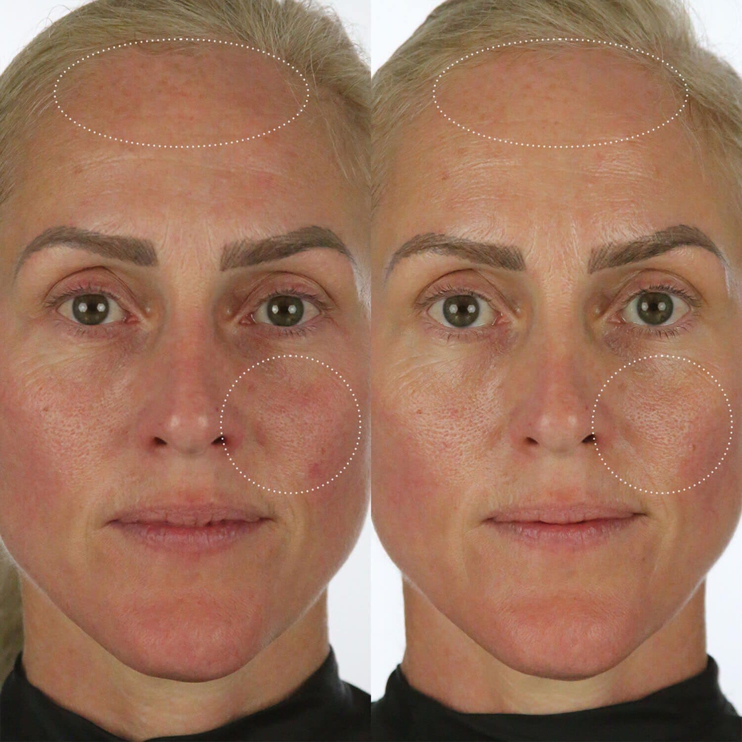 Milky Sunscreen SPF 50
