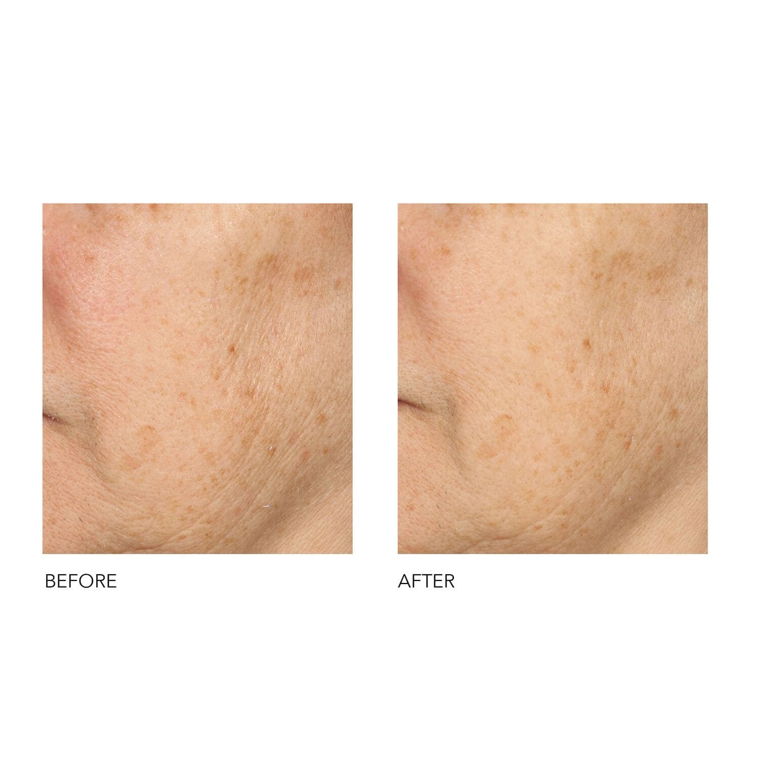 Alpha Beta® Universal Daily Peel 