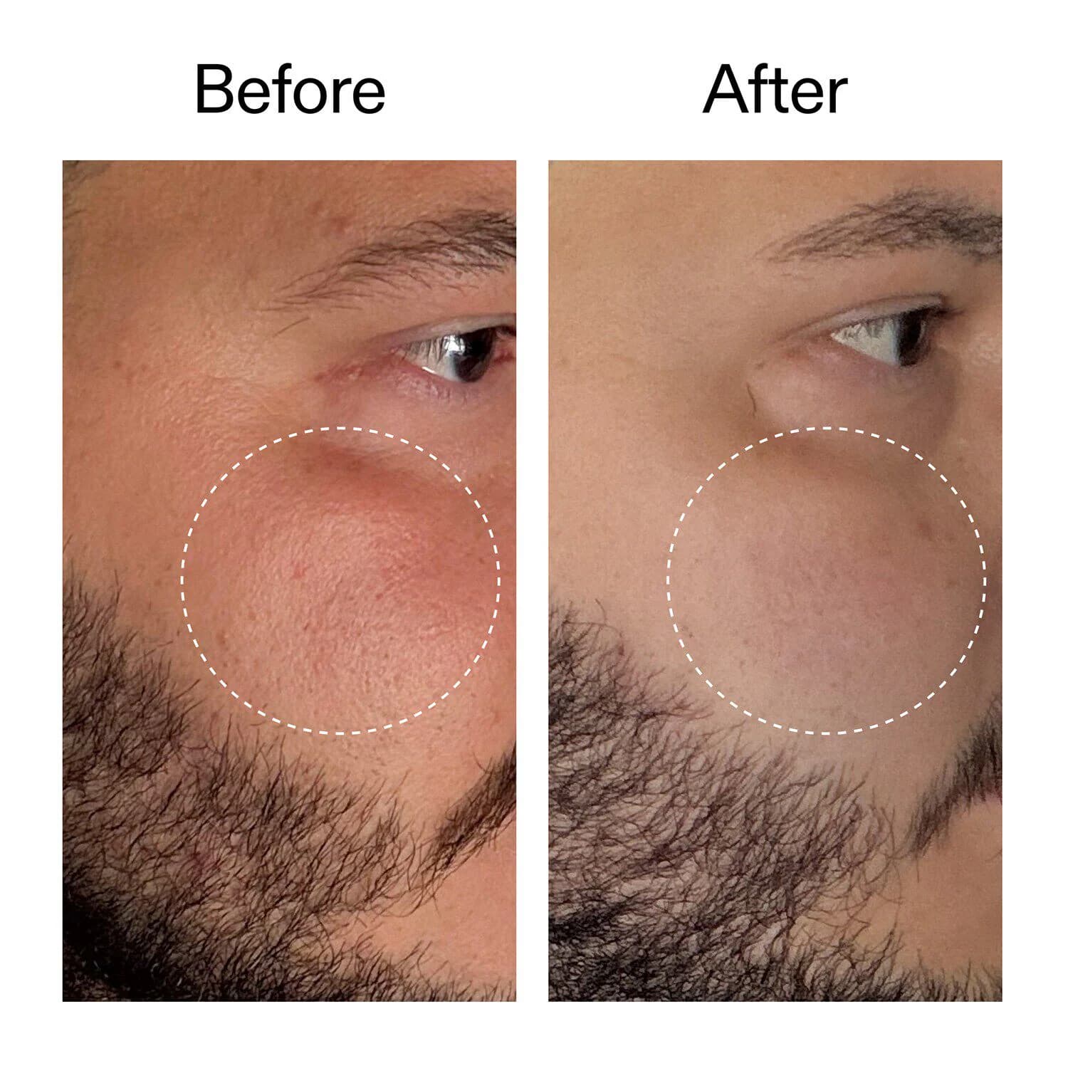 Starter Retinol Serum