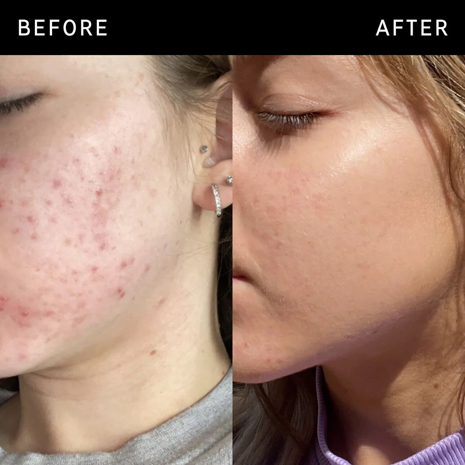 Niacinamide Serum