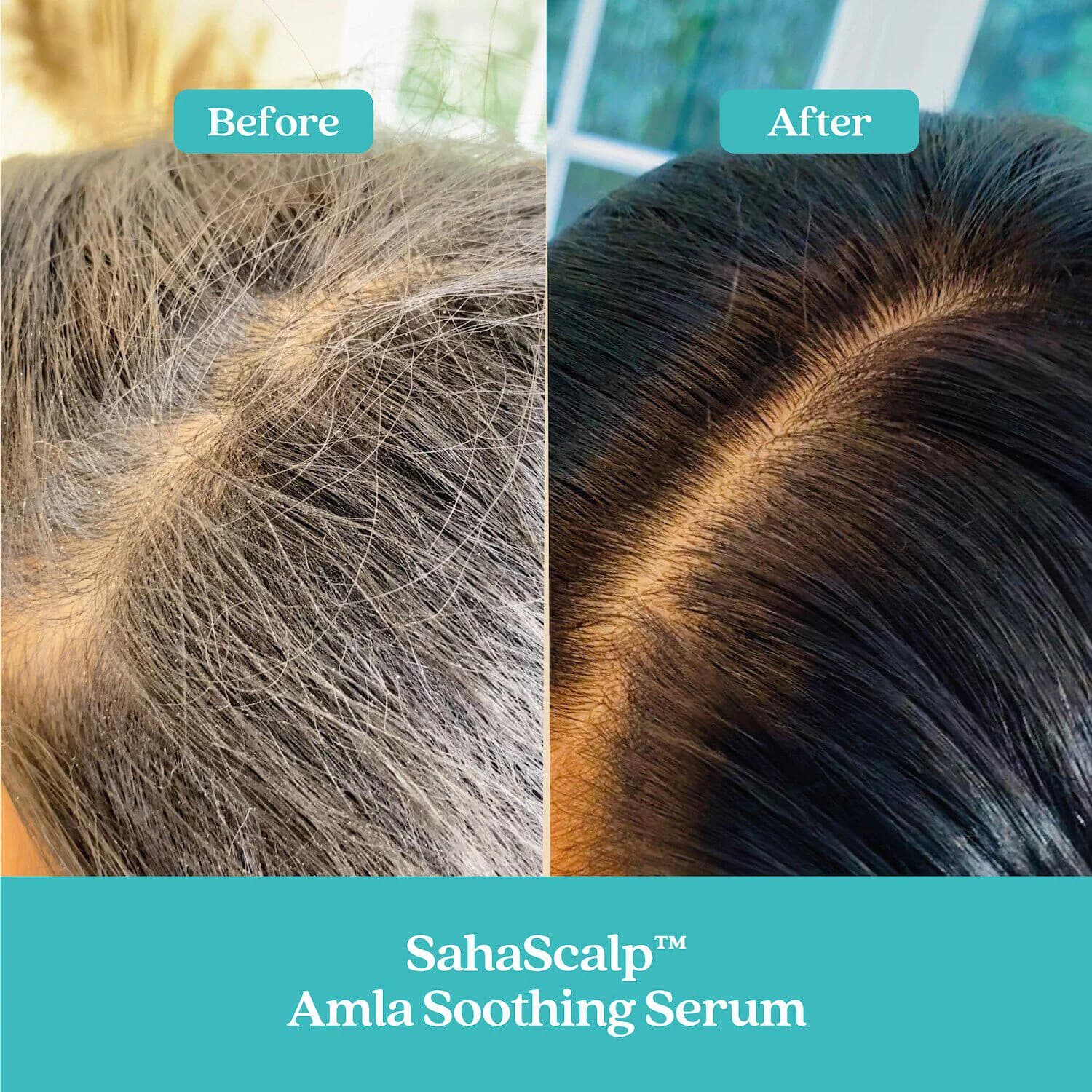 SahaScalp™ Amla Soothing Serum