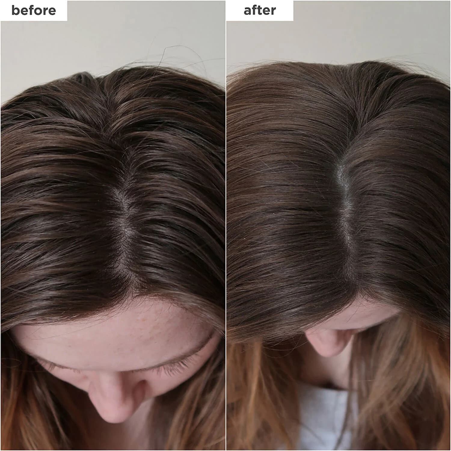 Scalp Revival™ Charcoal + Biotin Dry Shampoo