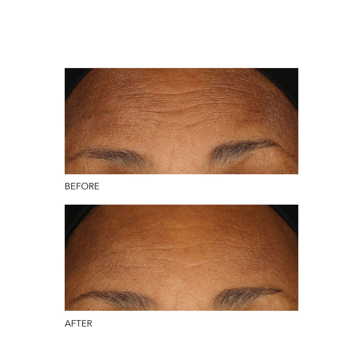 Alpha Beta® Peel Extra Strength Daily Peel