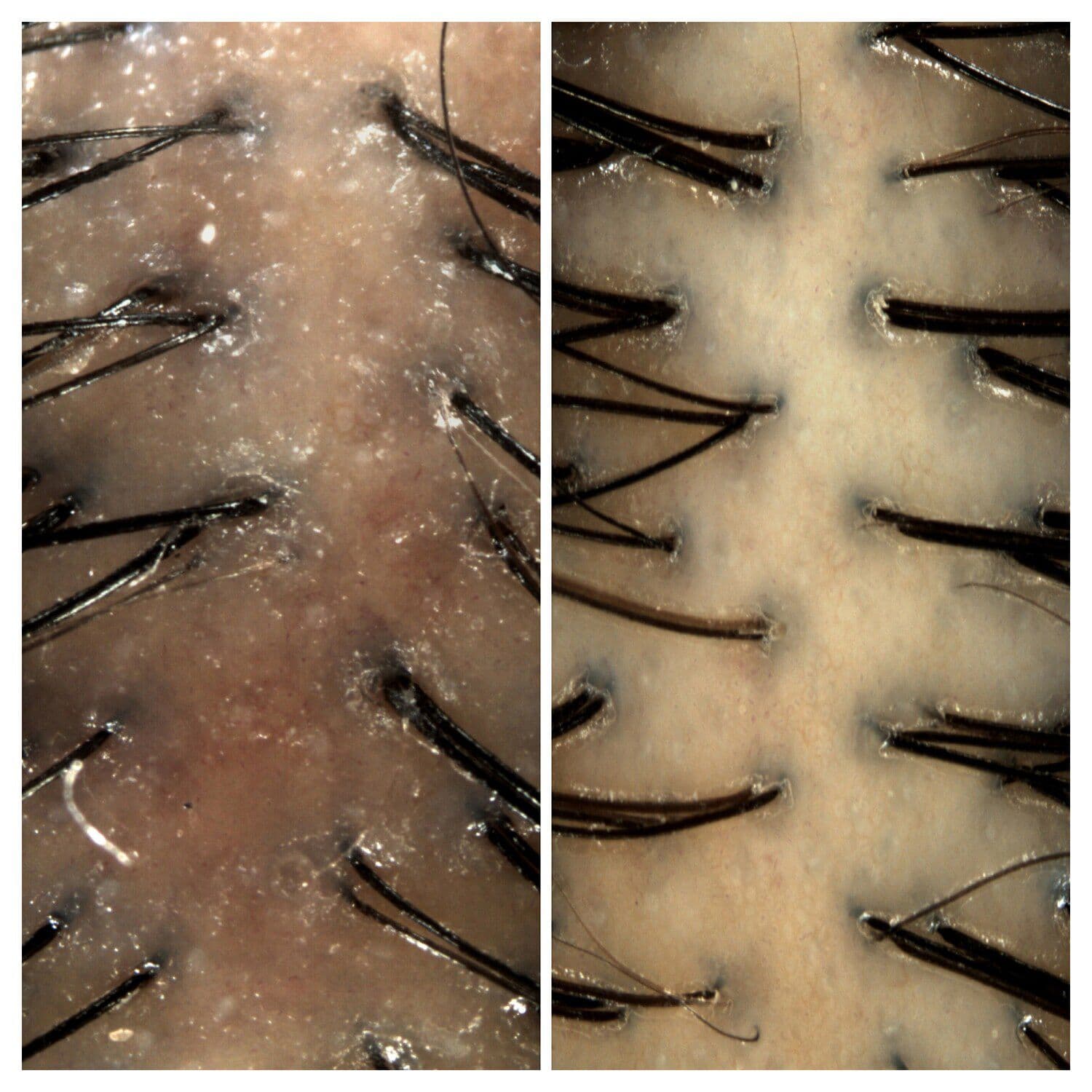 Amino Leave-In Scalp Bubble Treatment