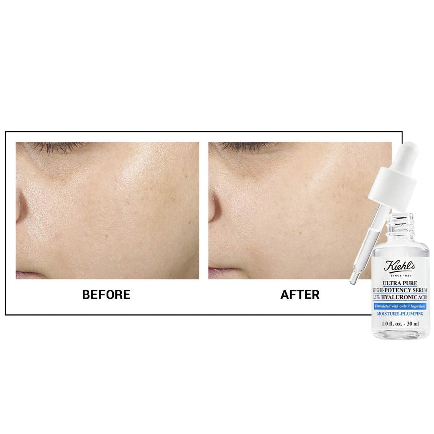 Ultra Pure High-Potency Serum 1.5% Hyaluronic Acid