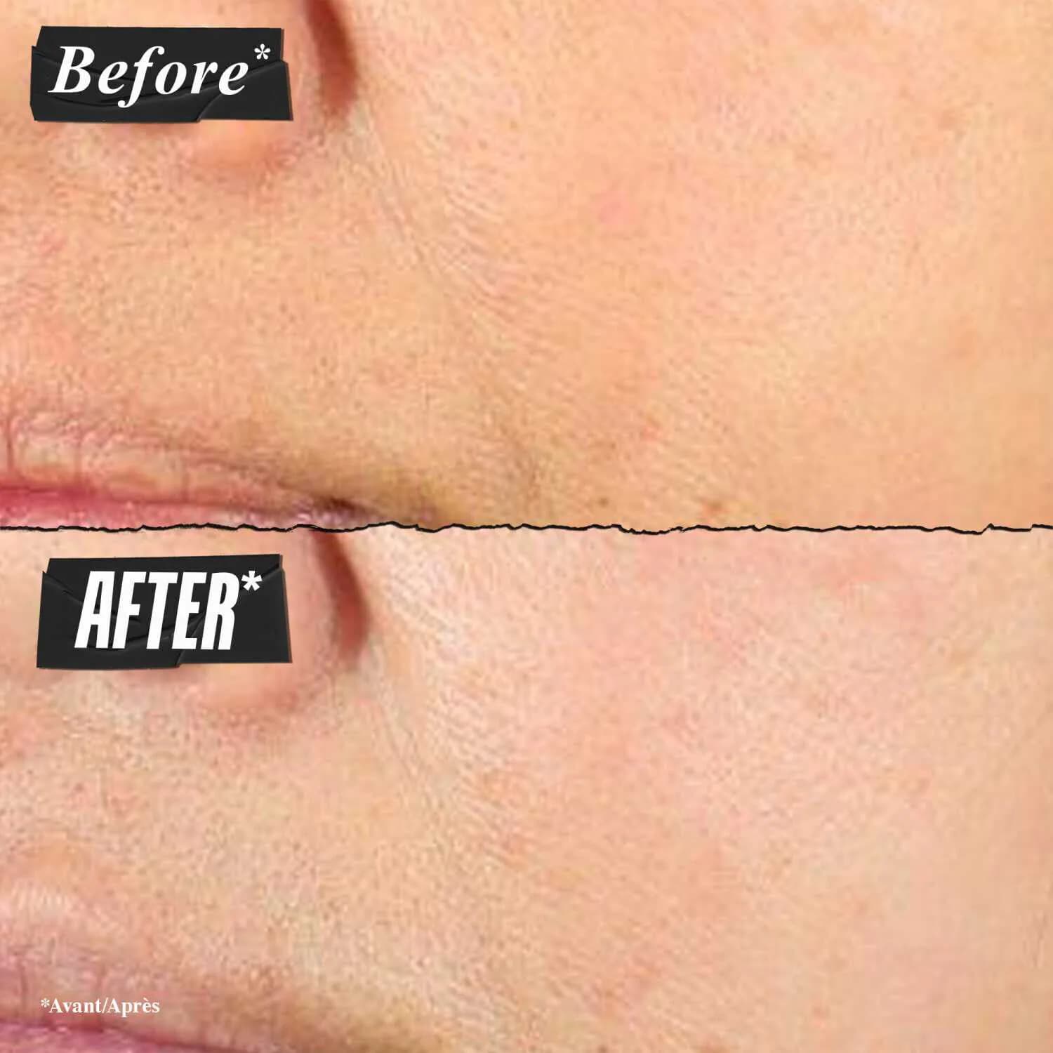 Super Multi-Corrective Anti-Aging Face and Neck Cream