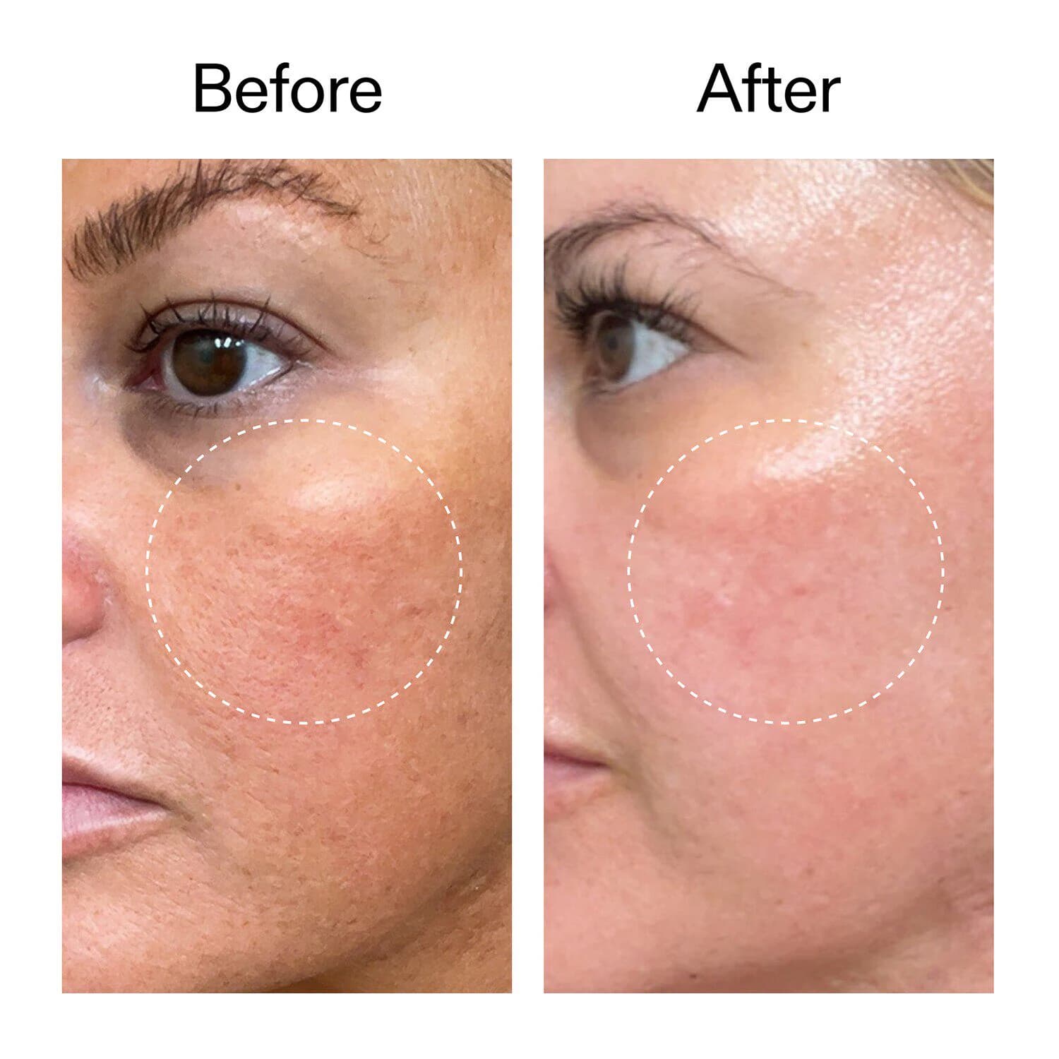 Starter Retinol Serum