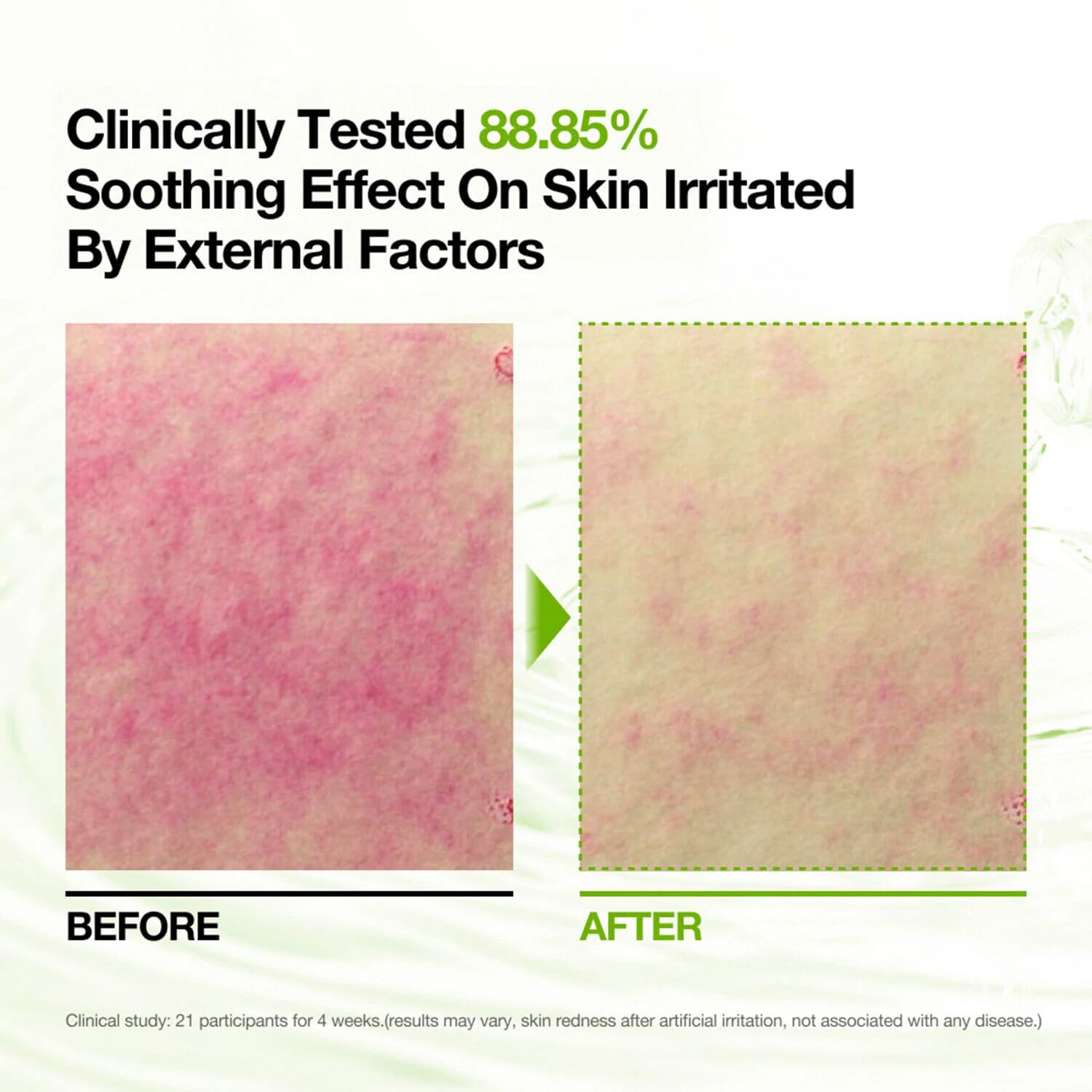 Azelaic 10 Hyaluron Redness Soothing Pad