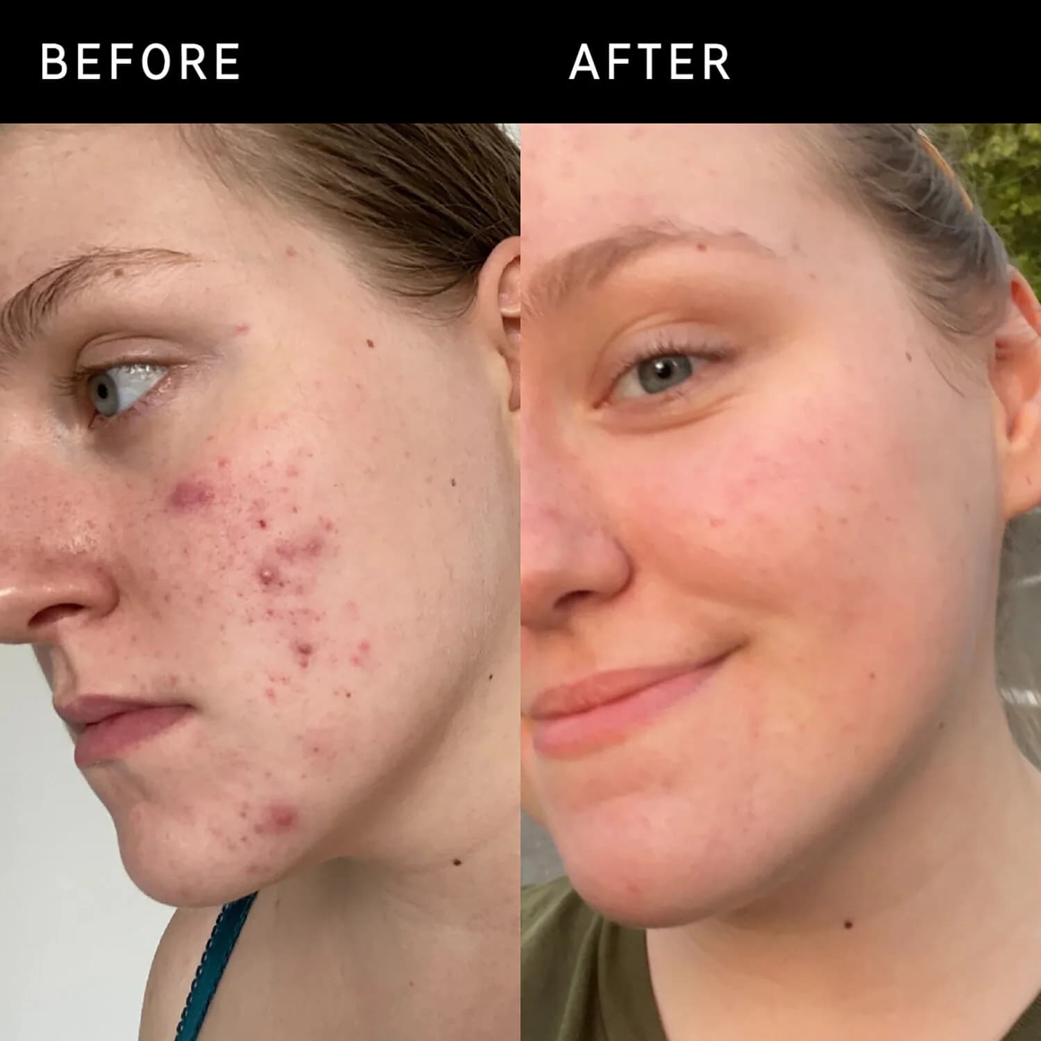 15% Vitamin C and EGF Brightening Serum