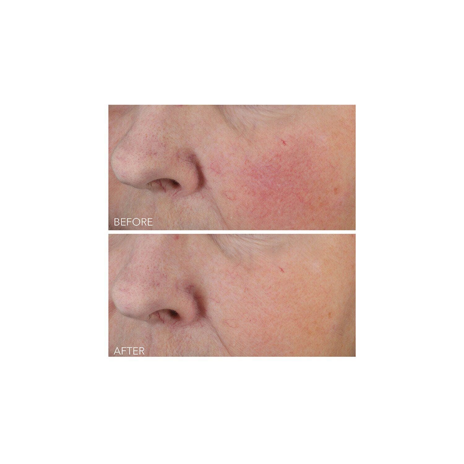 Vitamin C + Lactic Dewy Deep Cream