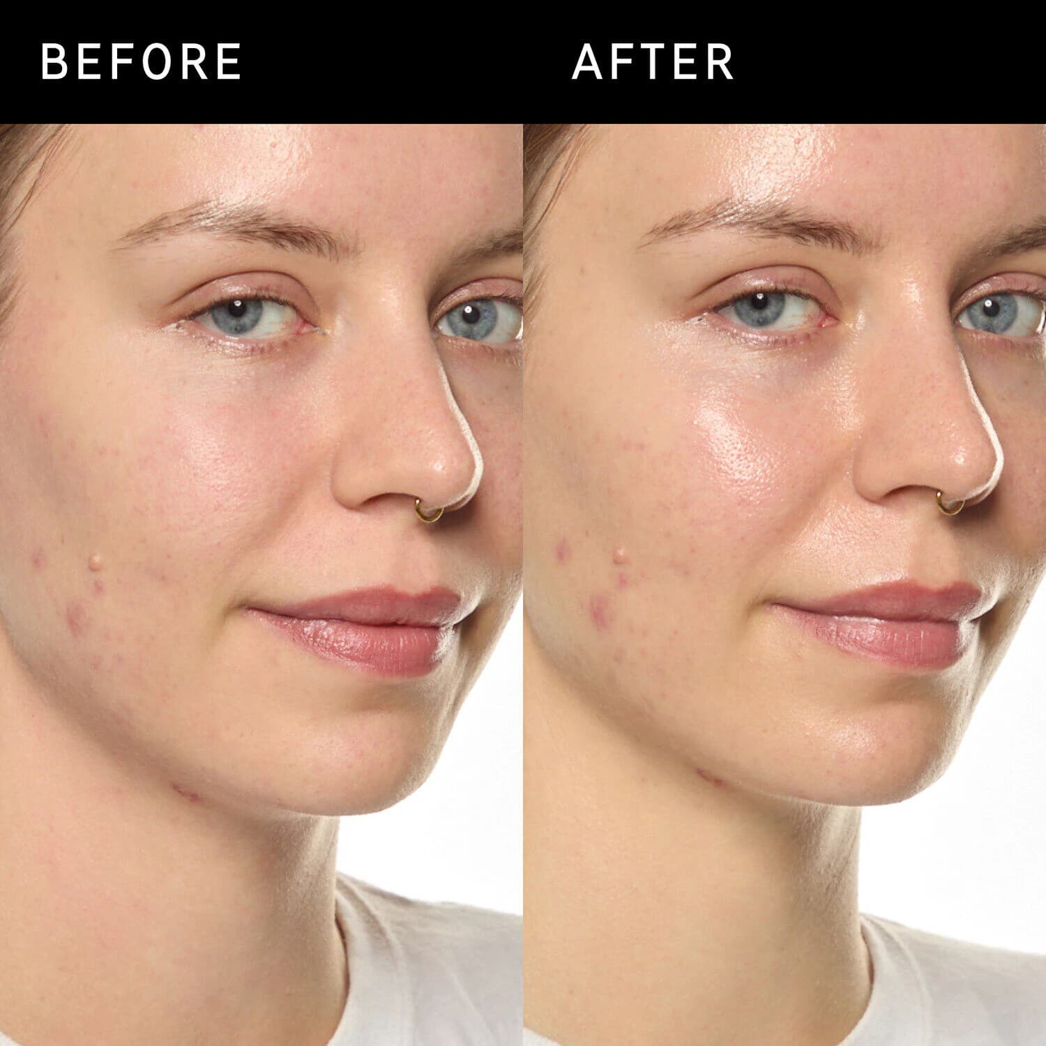 Ectoin Hydro-Barrier Serum