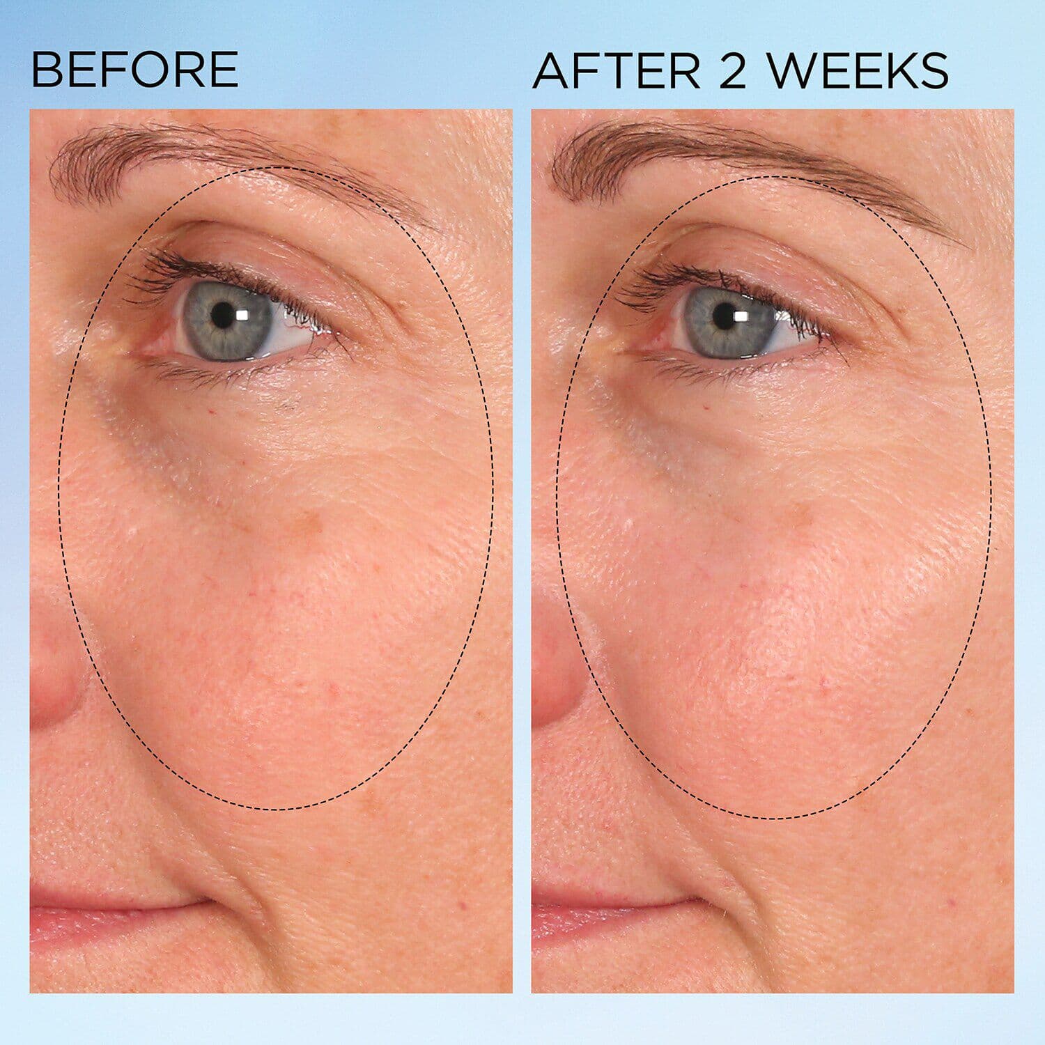 Visible Brightening Clearly Radiant Spot Correcting