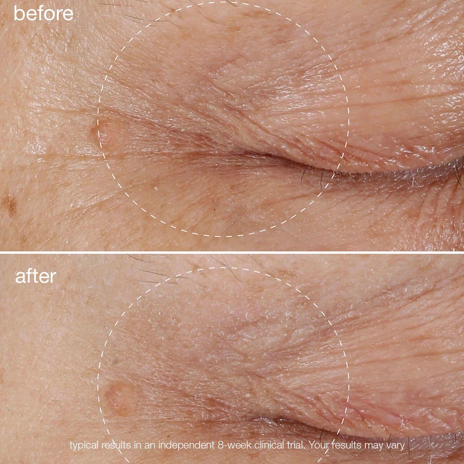 Biolumin-C Vitamin C Eye Serum