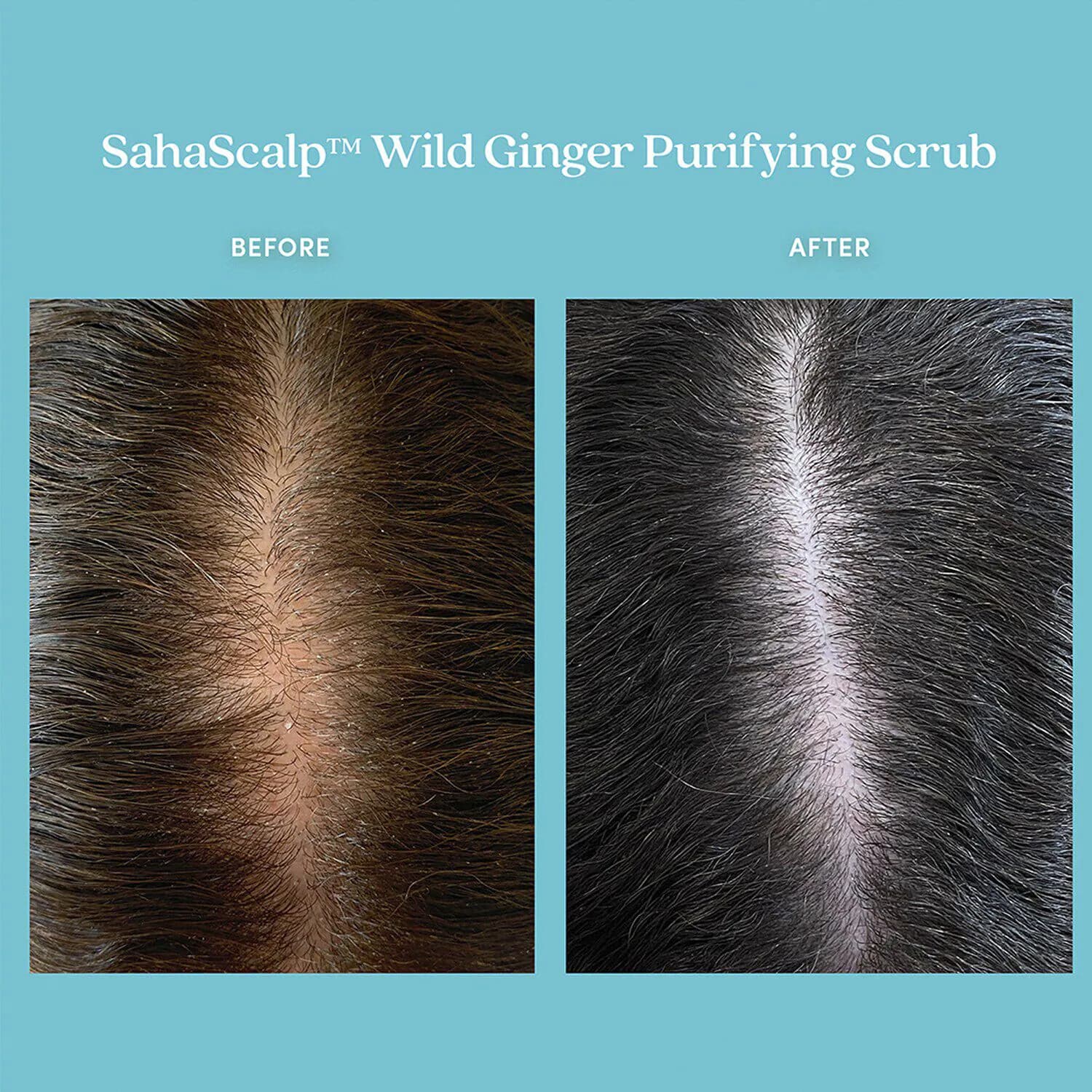 SahaScalp™ Wild Ginger Purifying Scrub