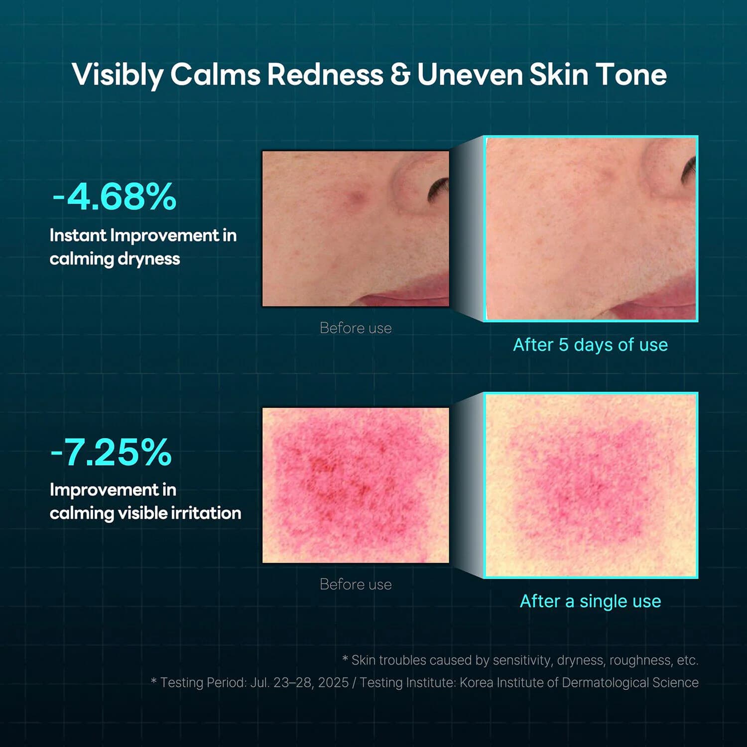 Madecassoside Derma Cream