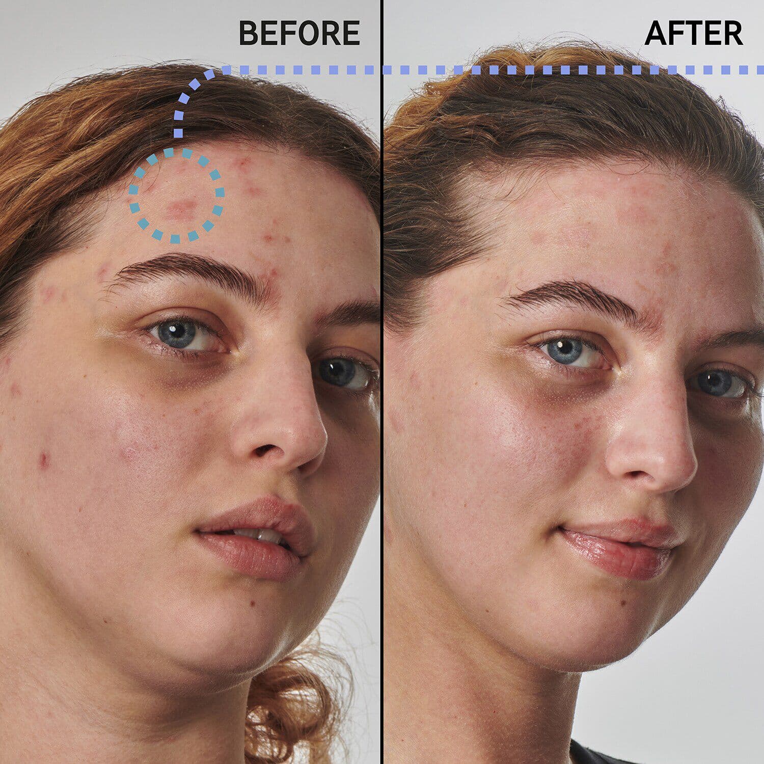 SuperSolutionsᐩ 10% Urea Moisturizer