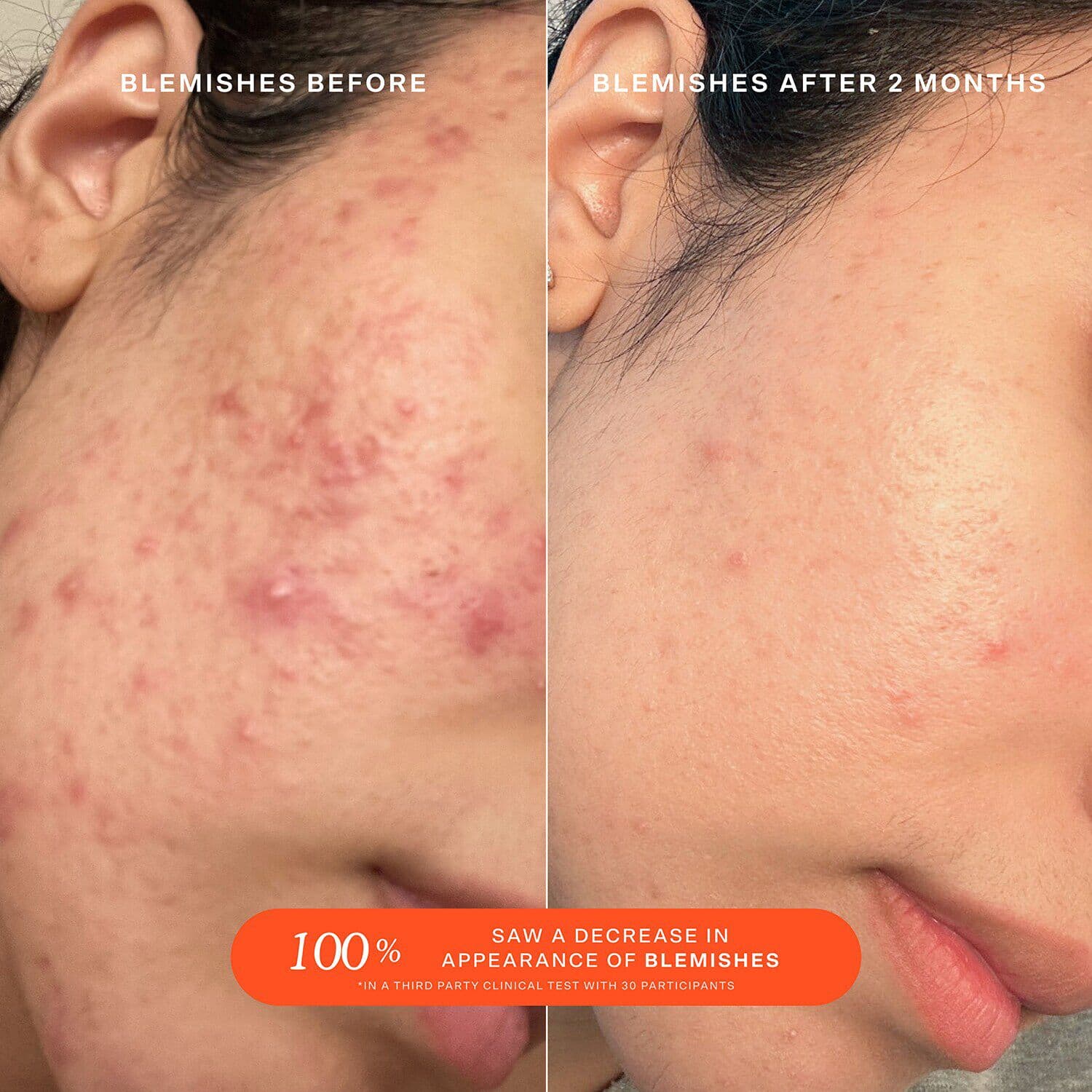 SOS Daily Rescue Facial Spray