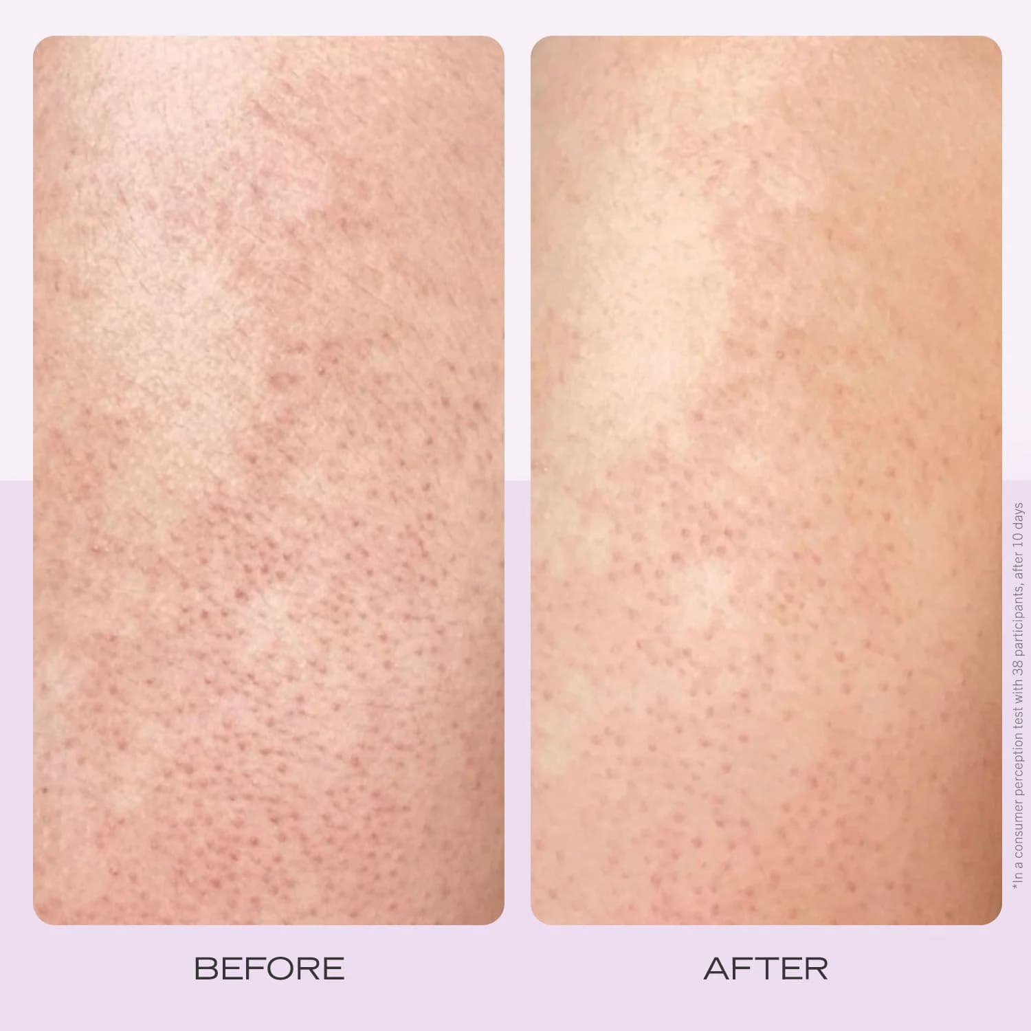 KP Bump Eraser Body Scrub with 10% AHA Fresh Strawberry