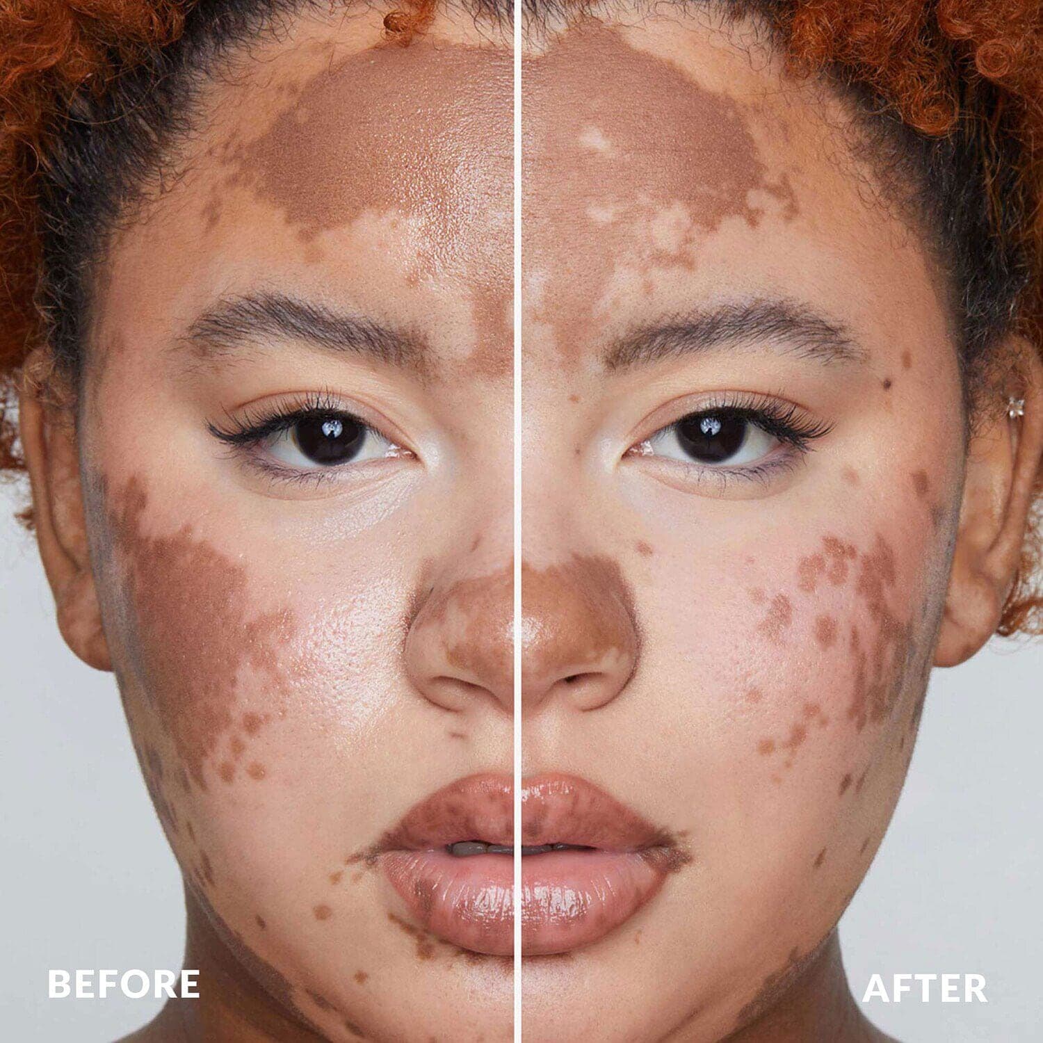 Skin Finish