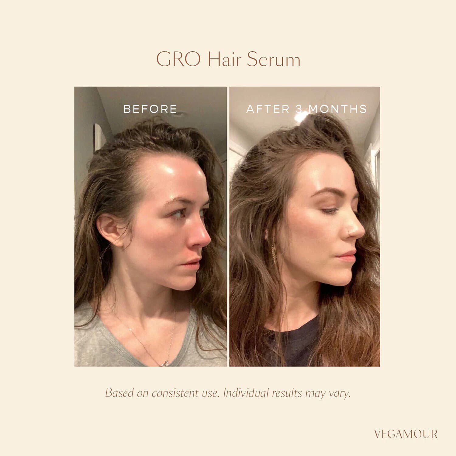GRO Hair Serum
